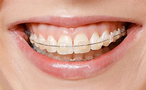 cocodental dentist providing professional dental care in uk clinic