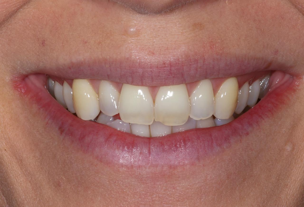 IMAGE 2025 05 06 111702 cocodental modern dental clinic providing professional care in uk