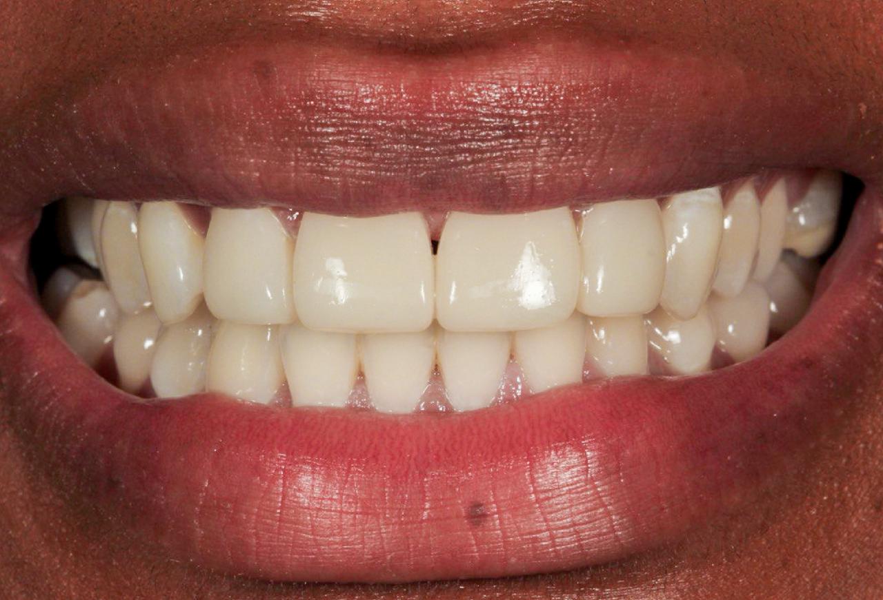 IMAGE 2025 05 06 112052 cocodental modern dental clinic providing professional care in uk
