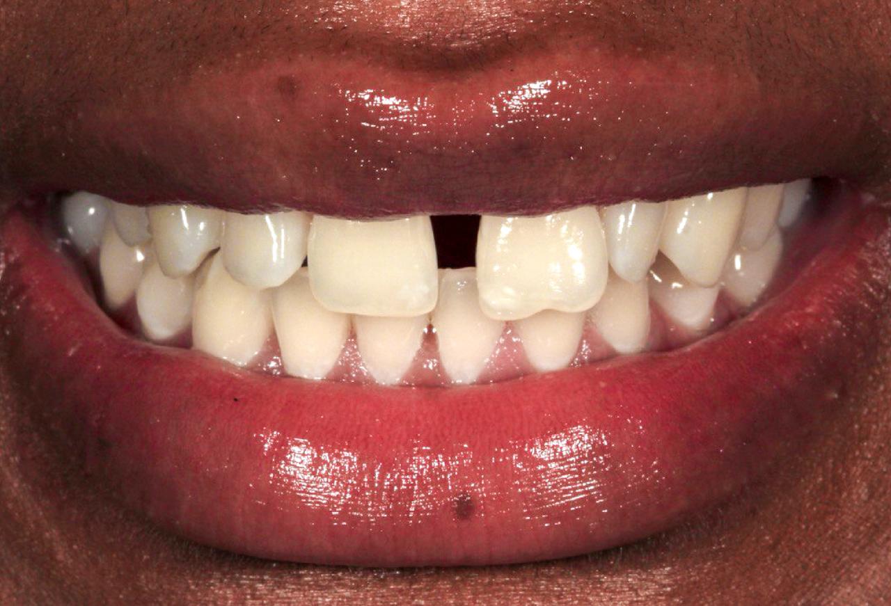 IMAGE 2025 05 06 112053 cocodental modern dental clinic providing professional care in uk