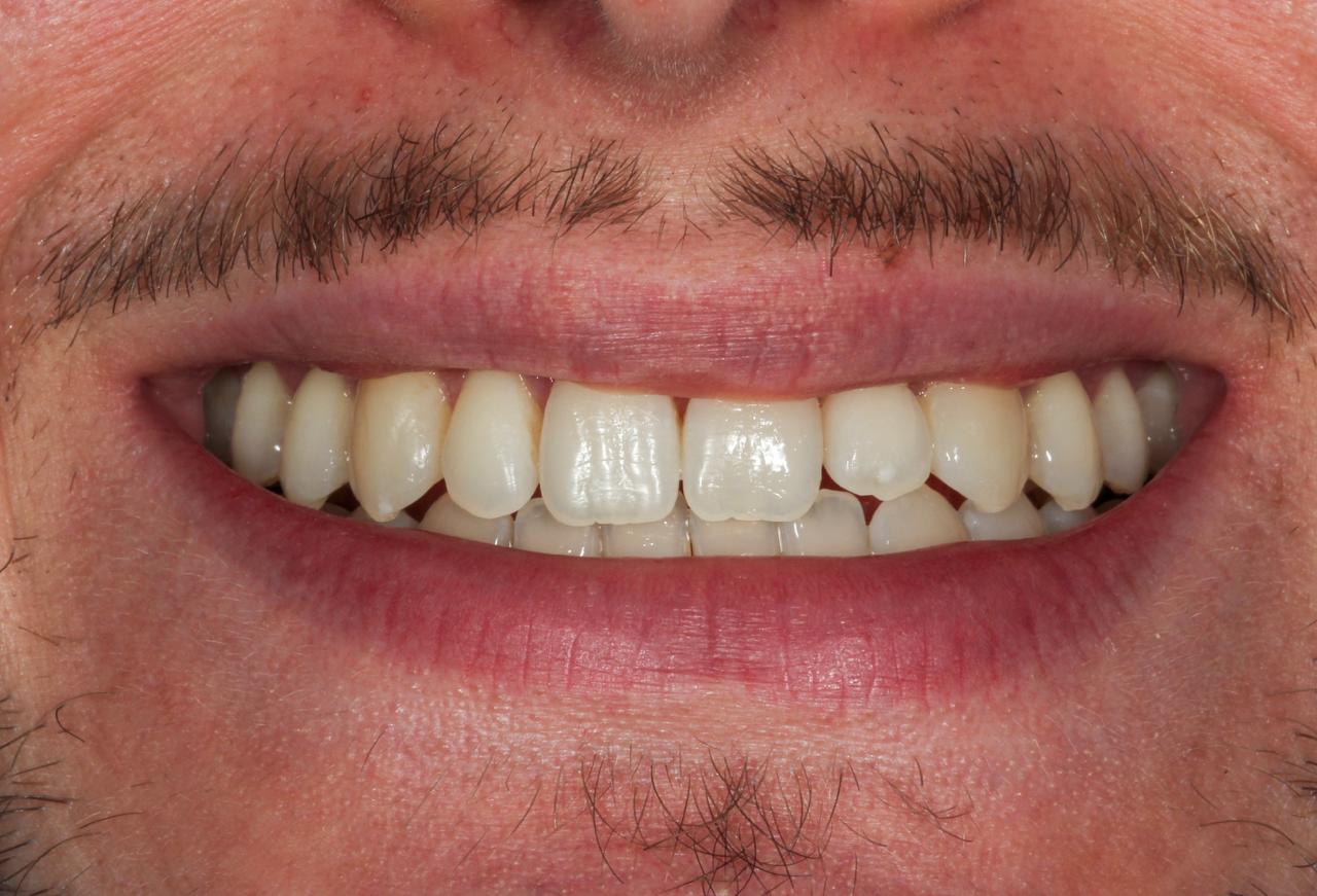 IMAGE 2025 05 06 112513 cocodental modern dental clinic providing professional care in uk