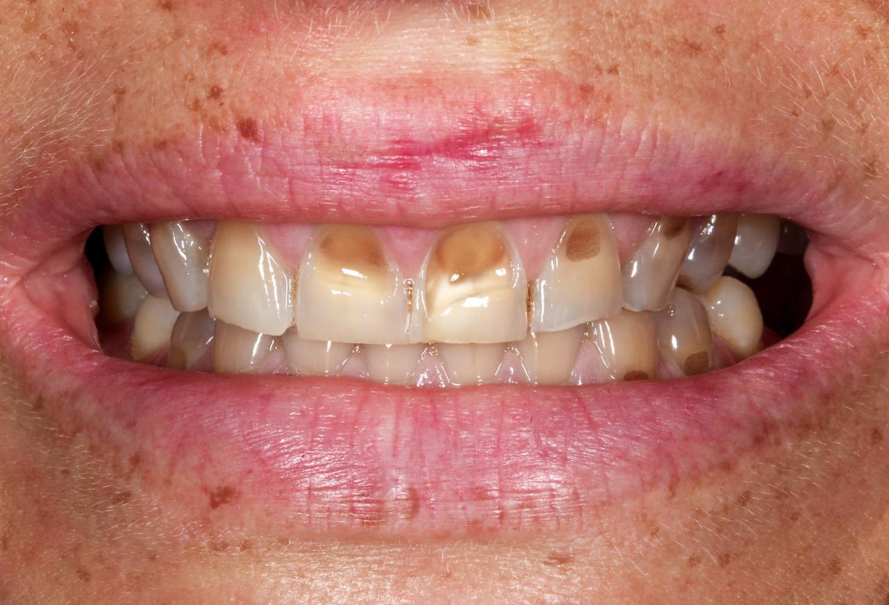 IMAGE 2025 05 06 112745 cocodental modern dental clinic providing professional care in uk