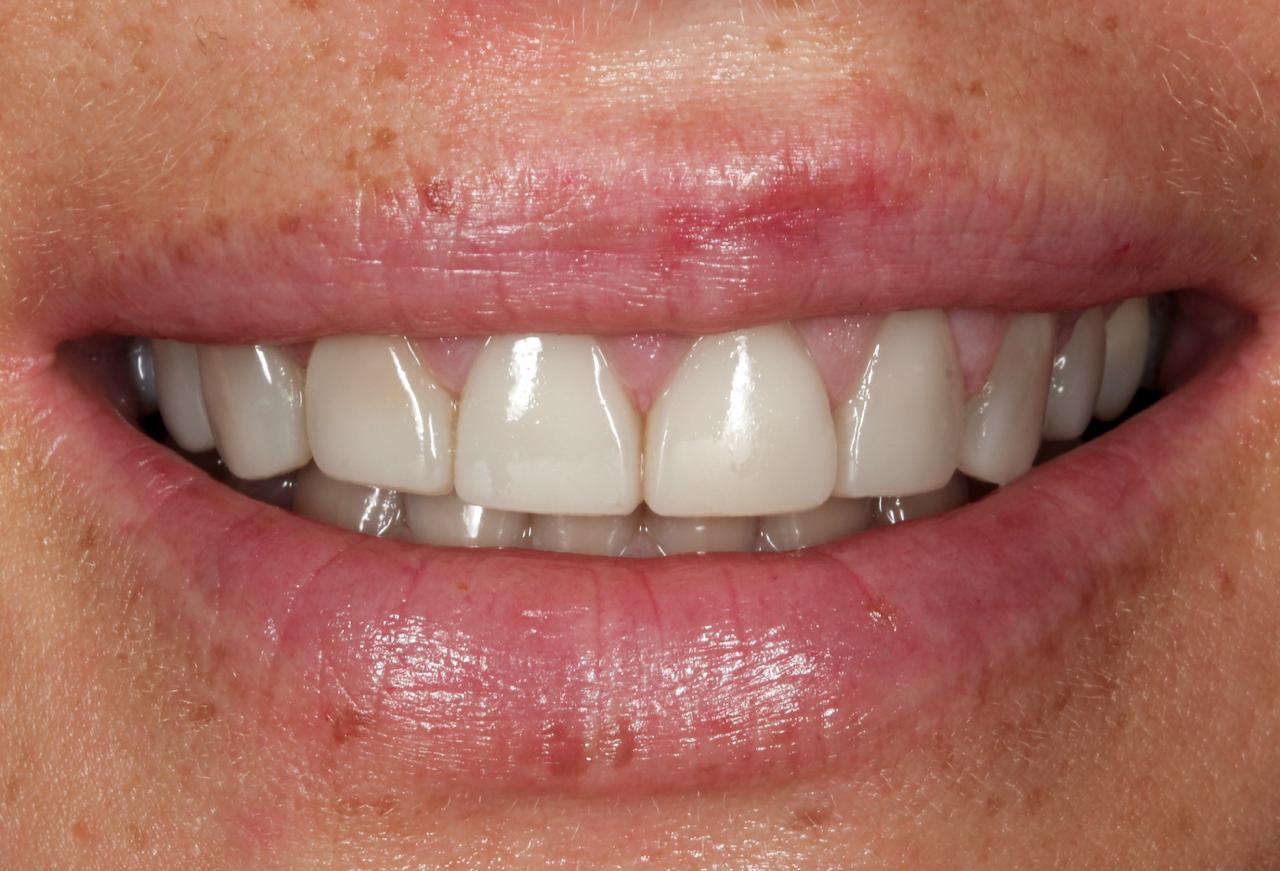 IMAGE 2025 05 06 112750 cocodental modern dental clinic providing professional care in uk