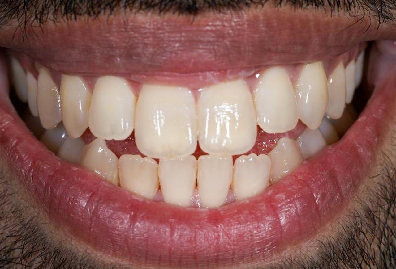 IMAGE 2025 05 06 113533 cocodental modern dental clinic providing professional care in uk