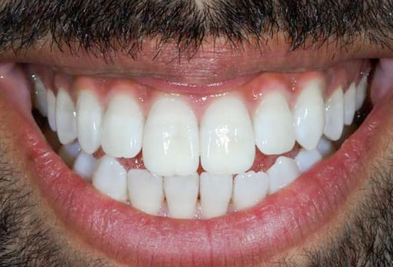 IMAGE 2025 05 06 113535 cocodental modern dental clinic providing professional care in uk