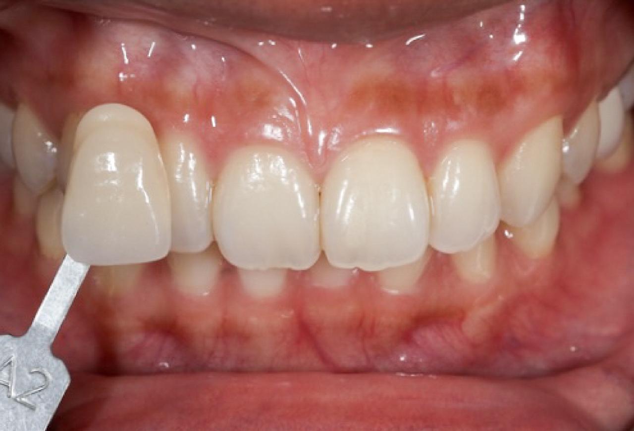 IMAGE 2025 05 06 114253 cocodental modern dental clinic providing professional care in uk