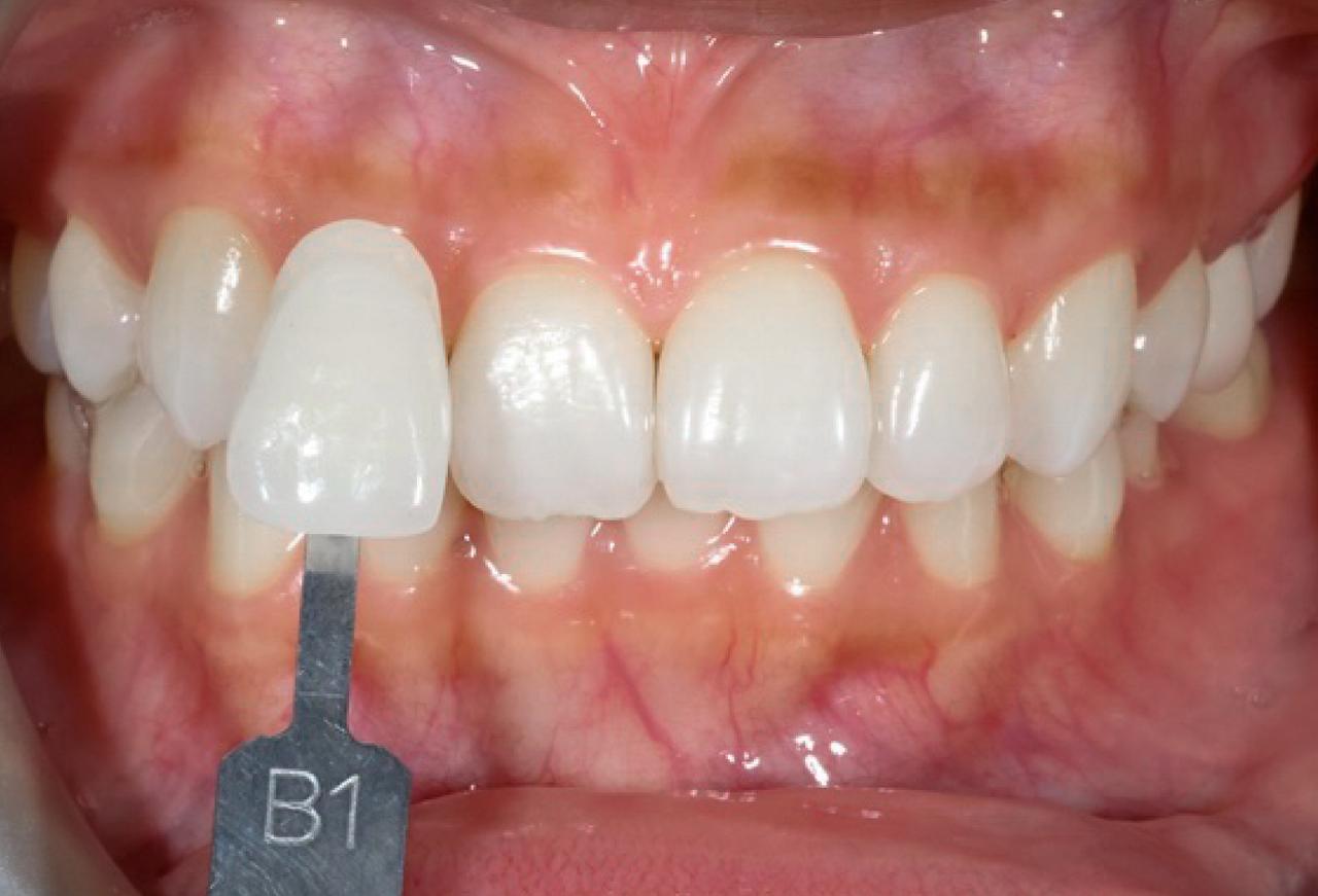 IMAGE 2025 05 06 114256 cocodental modern dental clinic providing professional care in uk