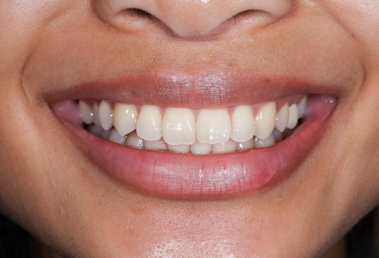 IMAGE 2025 05 06 114410 cocodental modern dental clinic providing professional care in uk