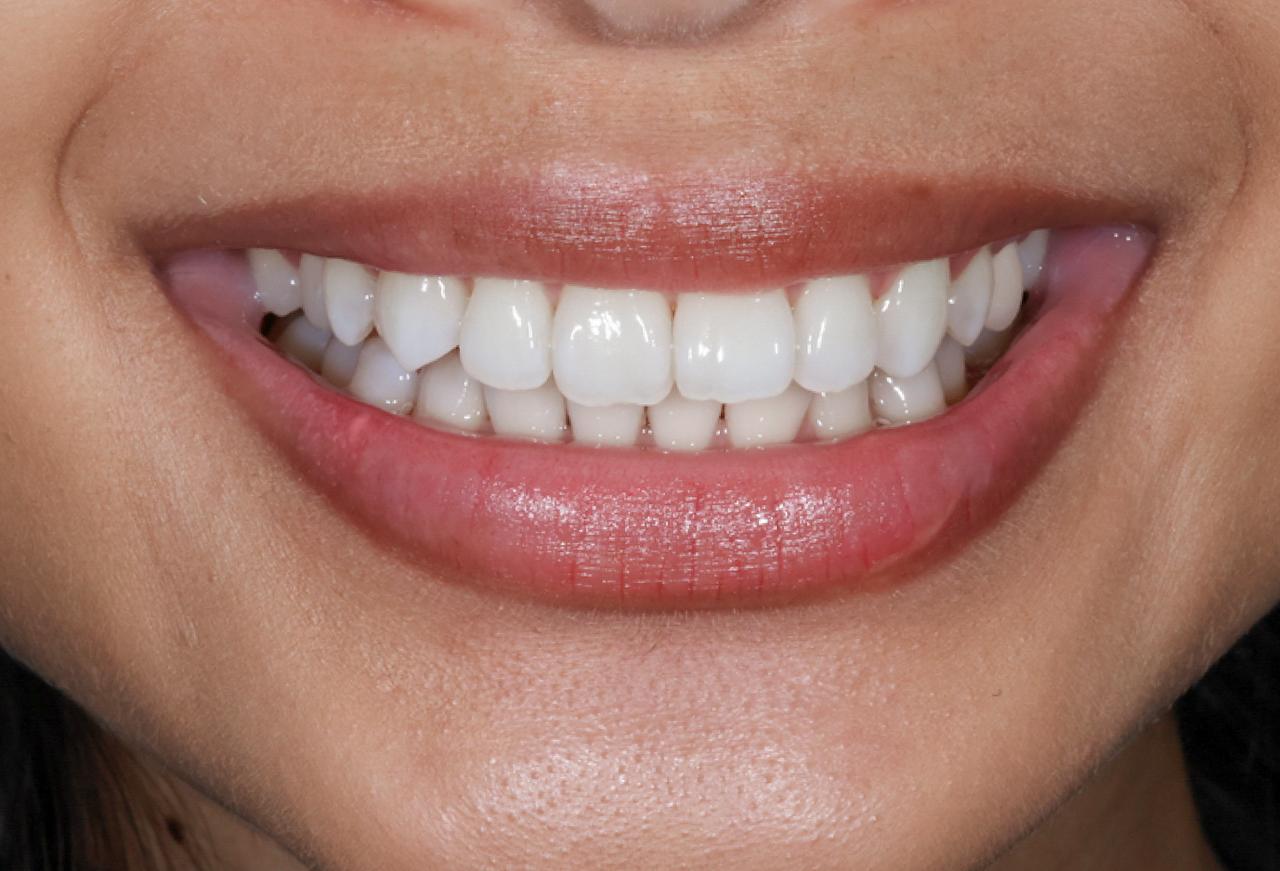 IMAGE 2025 05 06 114412 cocodental modern dental clinic providing professional care in uk
