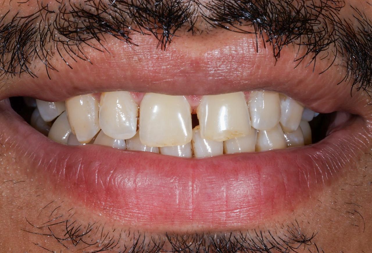 IMAGE 2025 05 06 114544 cocodental modern dental clinic providing professional care in uk