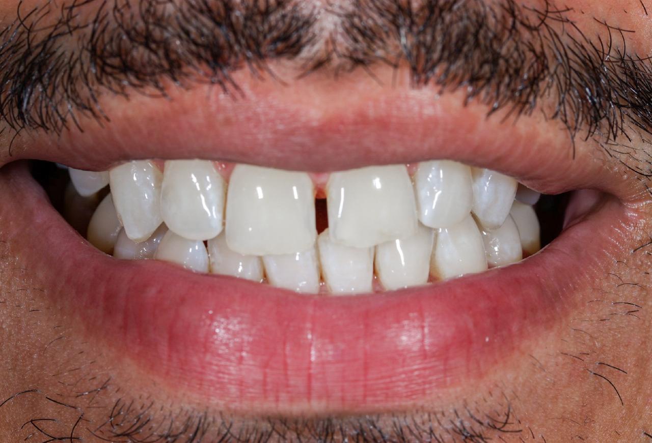 IMAGE 2025 05 06 114546 cocodental modern dental clinic providing professional care in uk