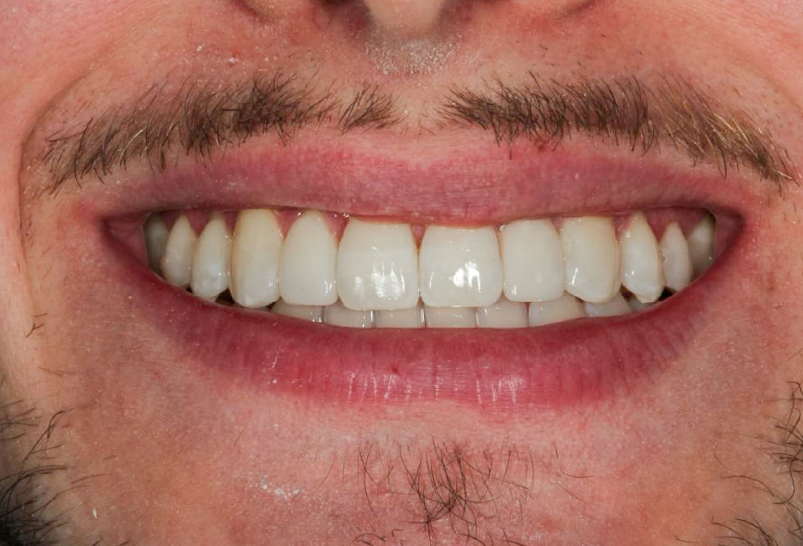 Smile Gallery 082 cocodental modern dental clinic providing professional care in uk