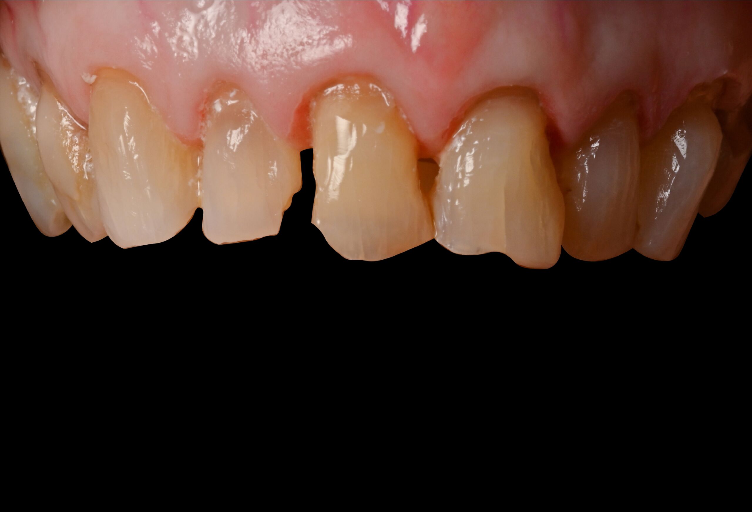 Smile Gallery 192 cocodental modern dental clinic providing professional care in uk