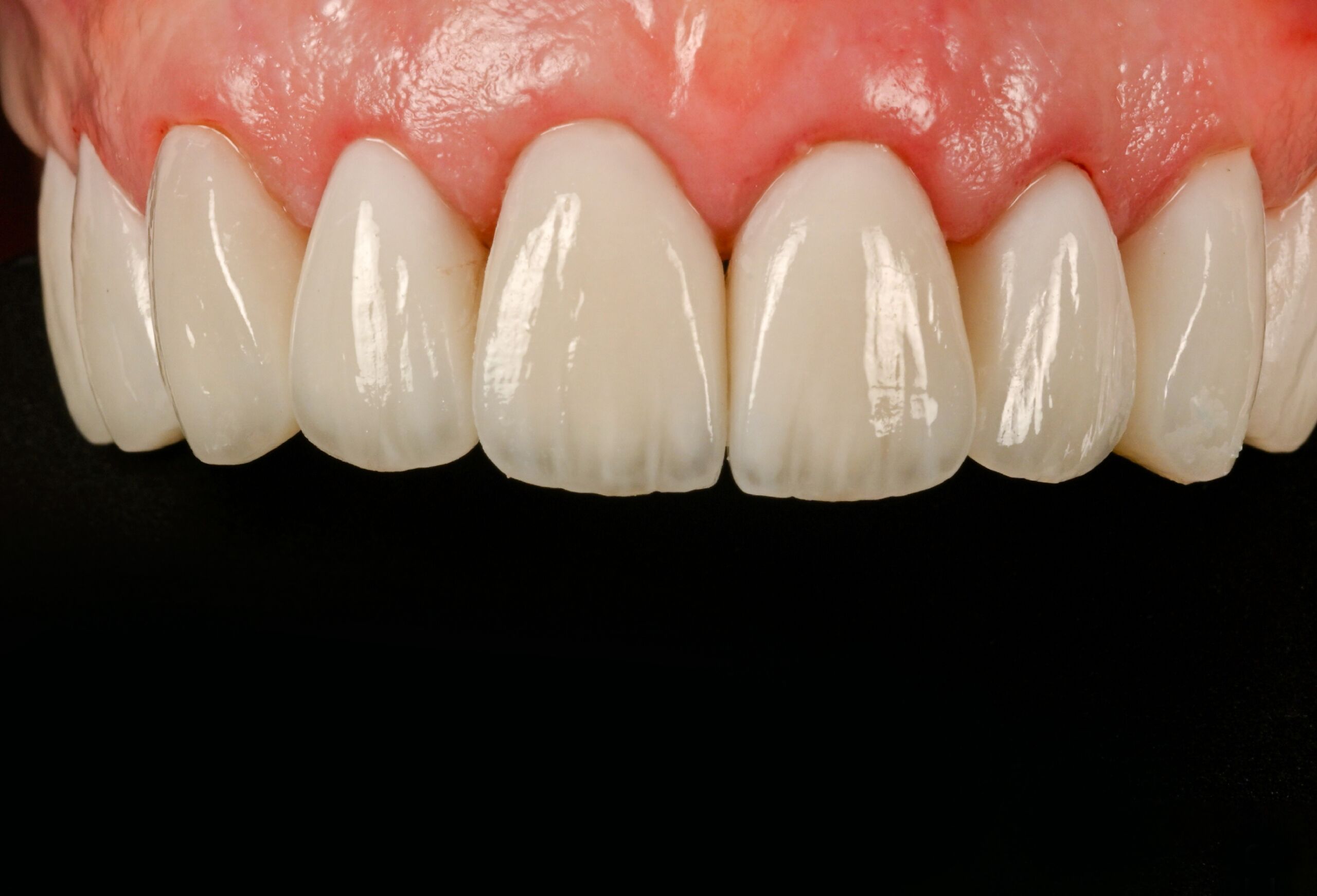 Smile Gallery 202 cocodental modern dental clinic providing professional care in uk