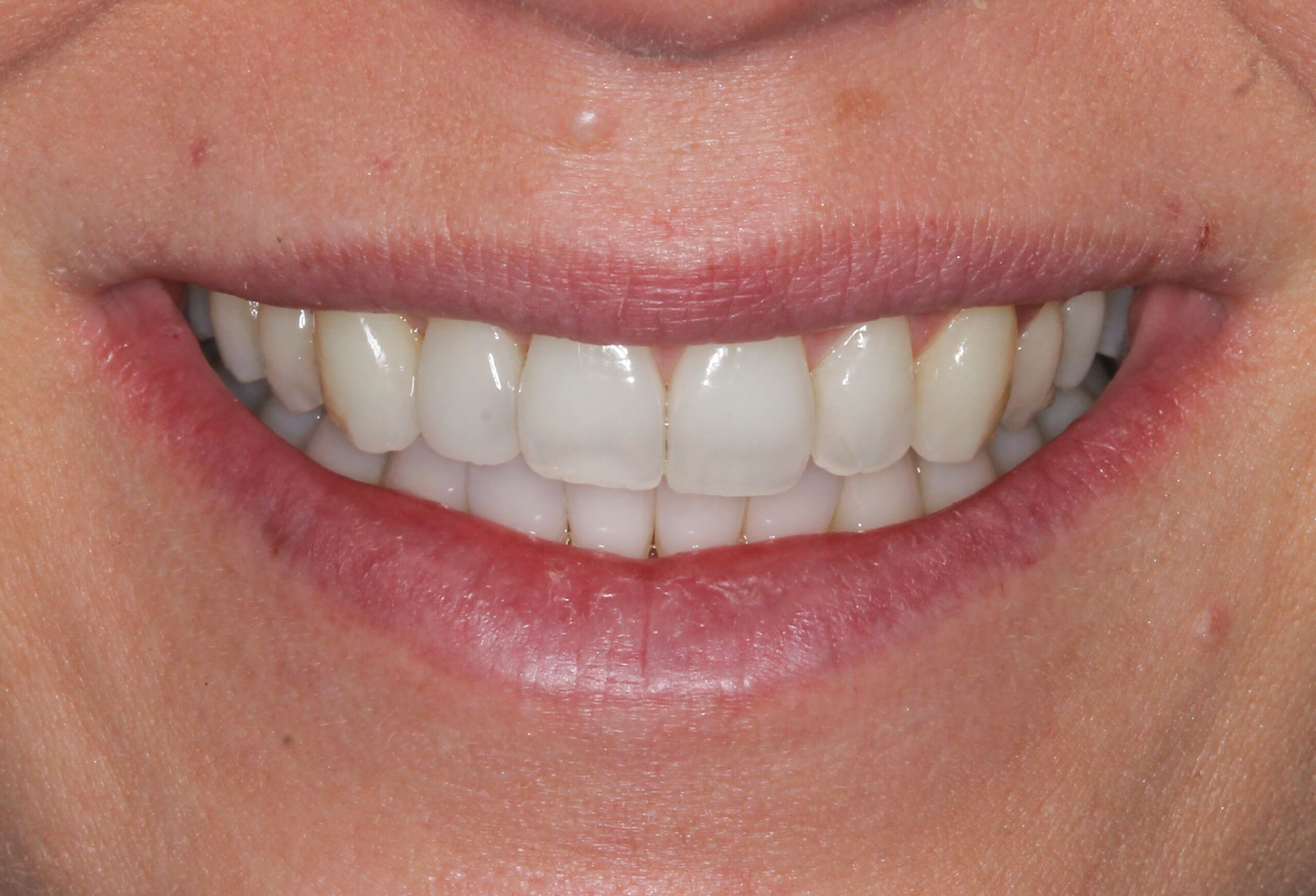 Smile Gallery 302 cocodental modern dental clinic providing professional care in uk