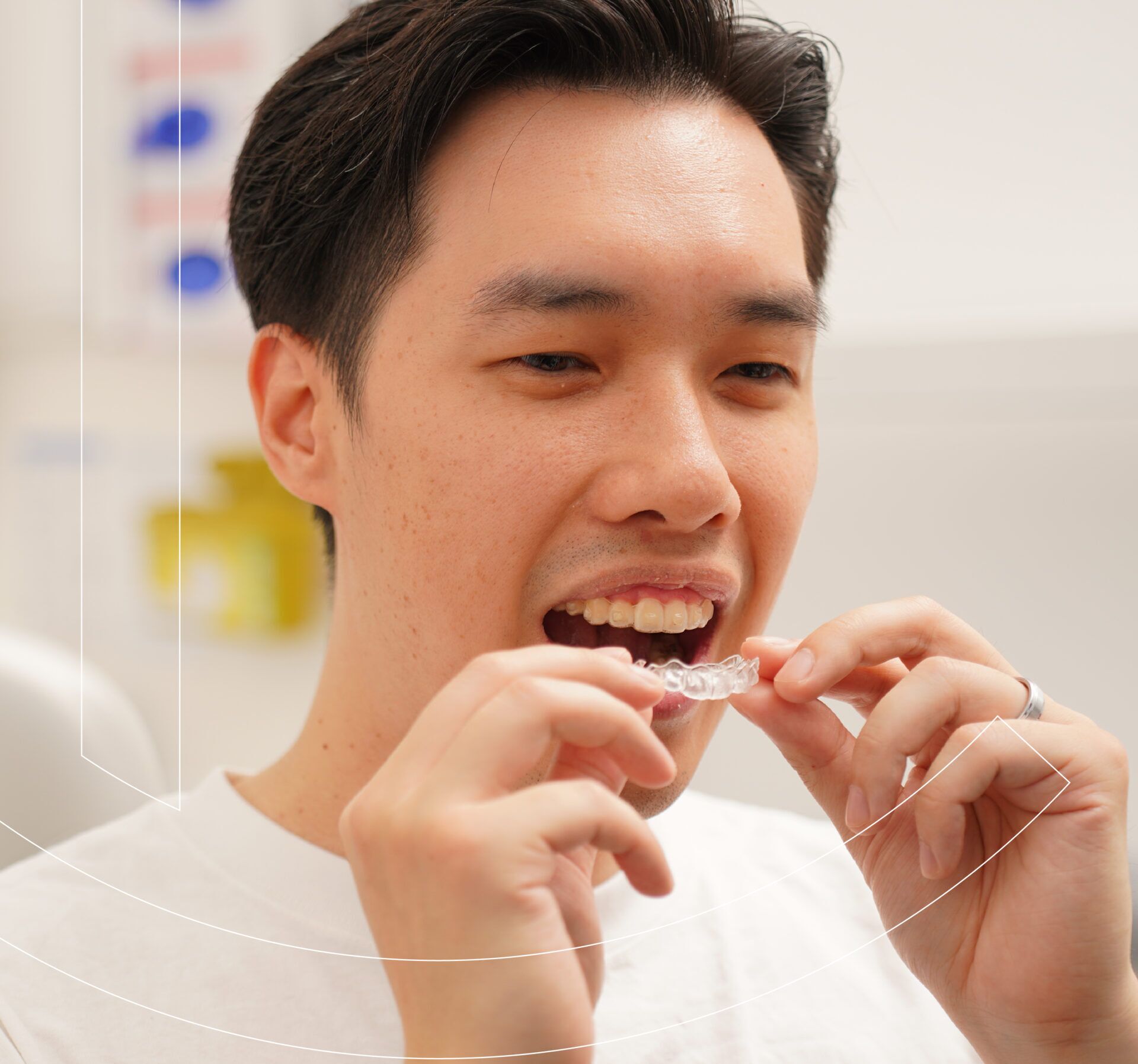 Монтажная область 8 e1747323481427 cocodental modern dental clinic providing professional care in uk