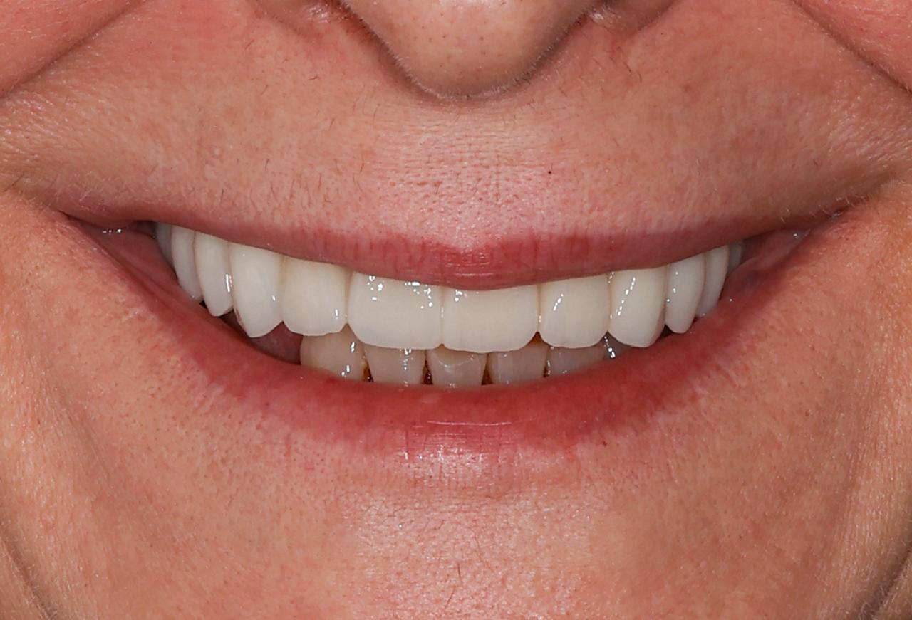 IMAGE 2025 05 06 120849 cocodental modern dental clinic providing professional care in uk