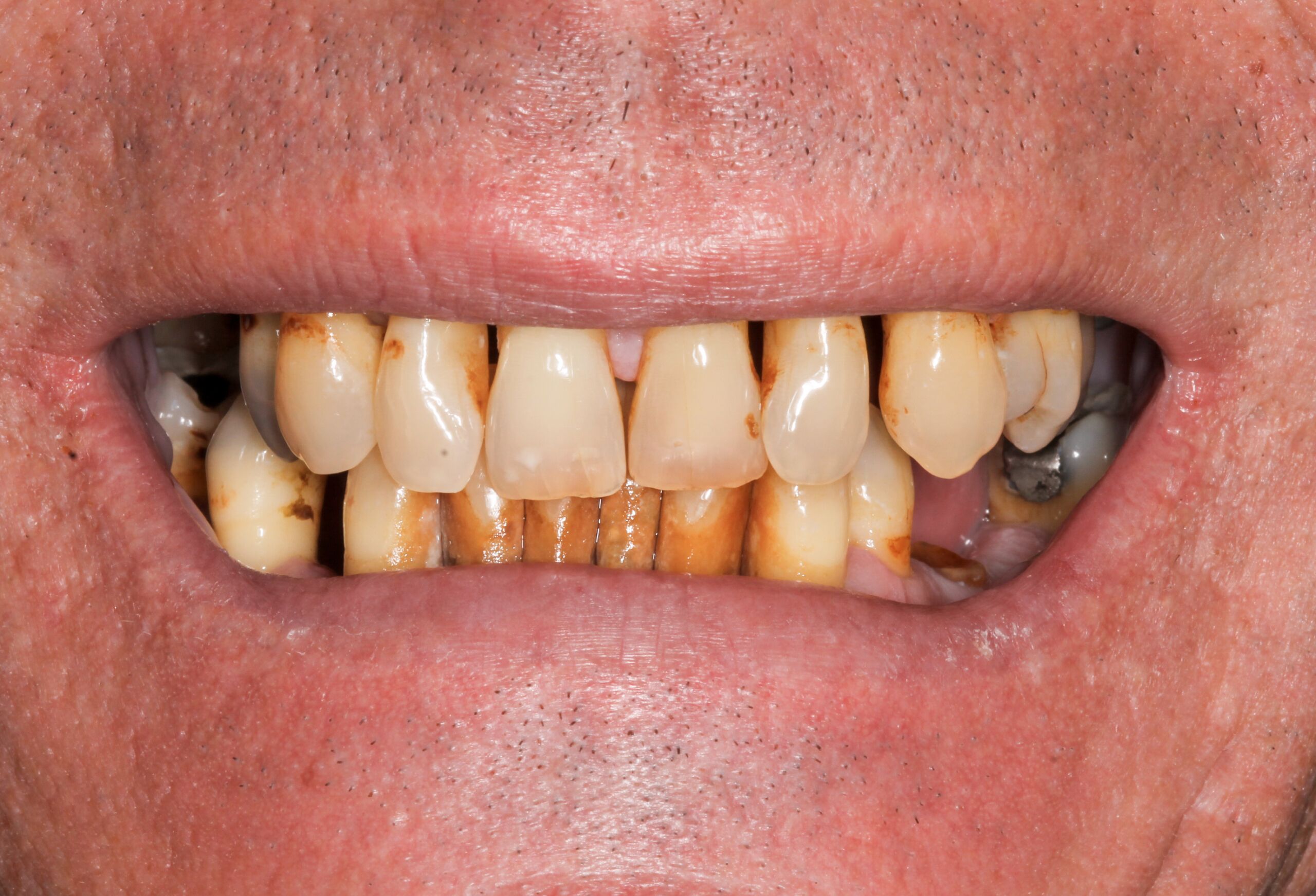 Smile Gallery 45 cocodental modern dental clinic providing professional care in uk