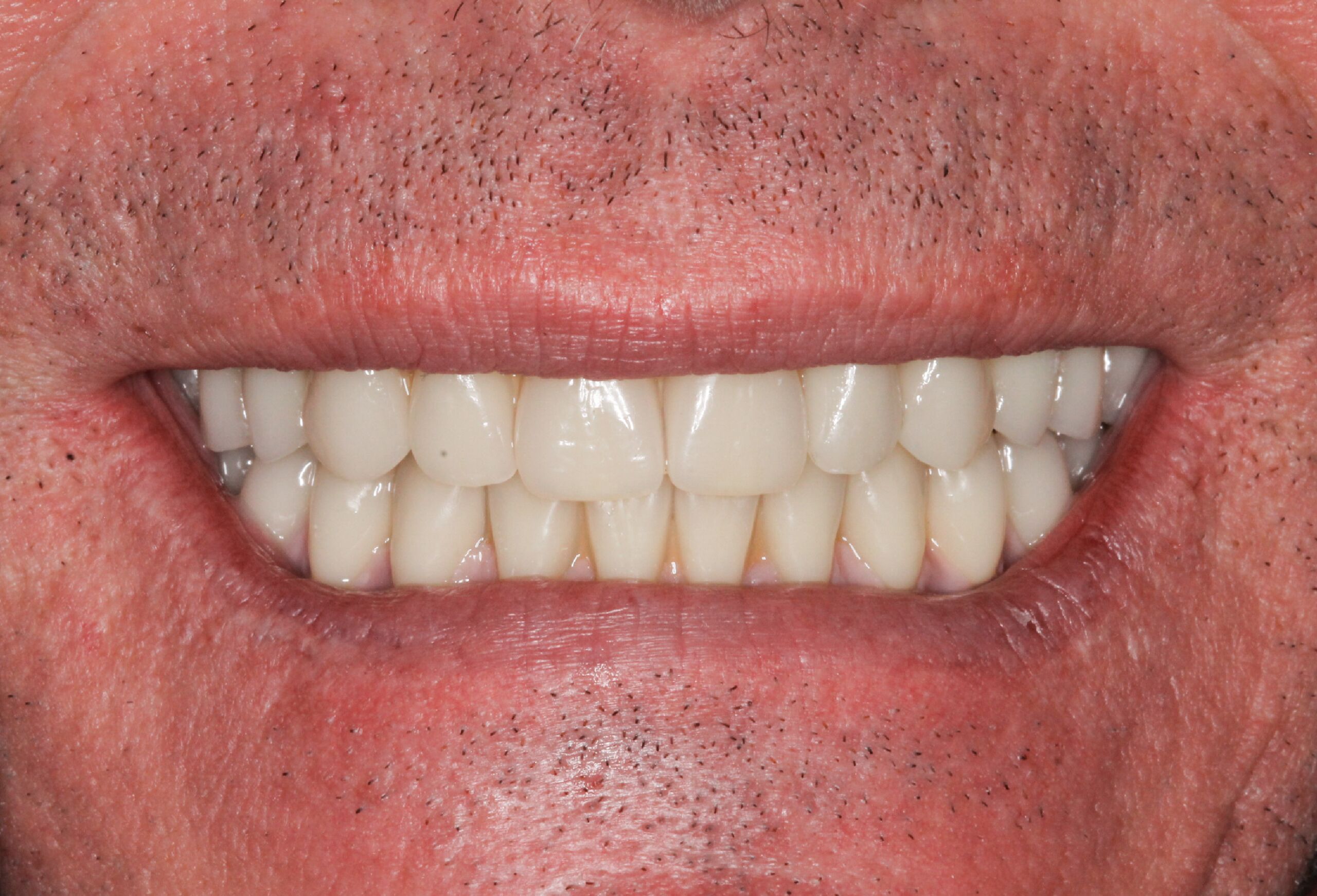 Smile Gallery 46 cocodental modern dental clinic providing professional care in uk
