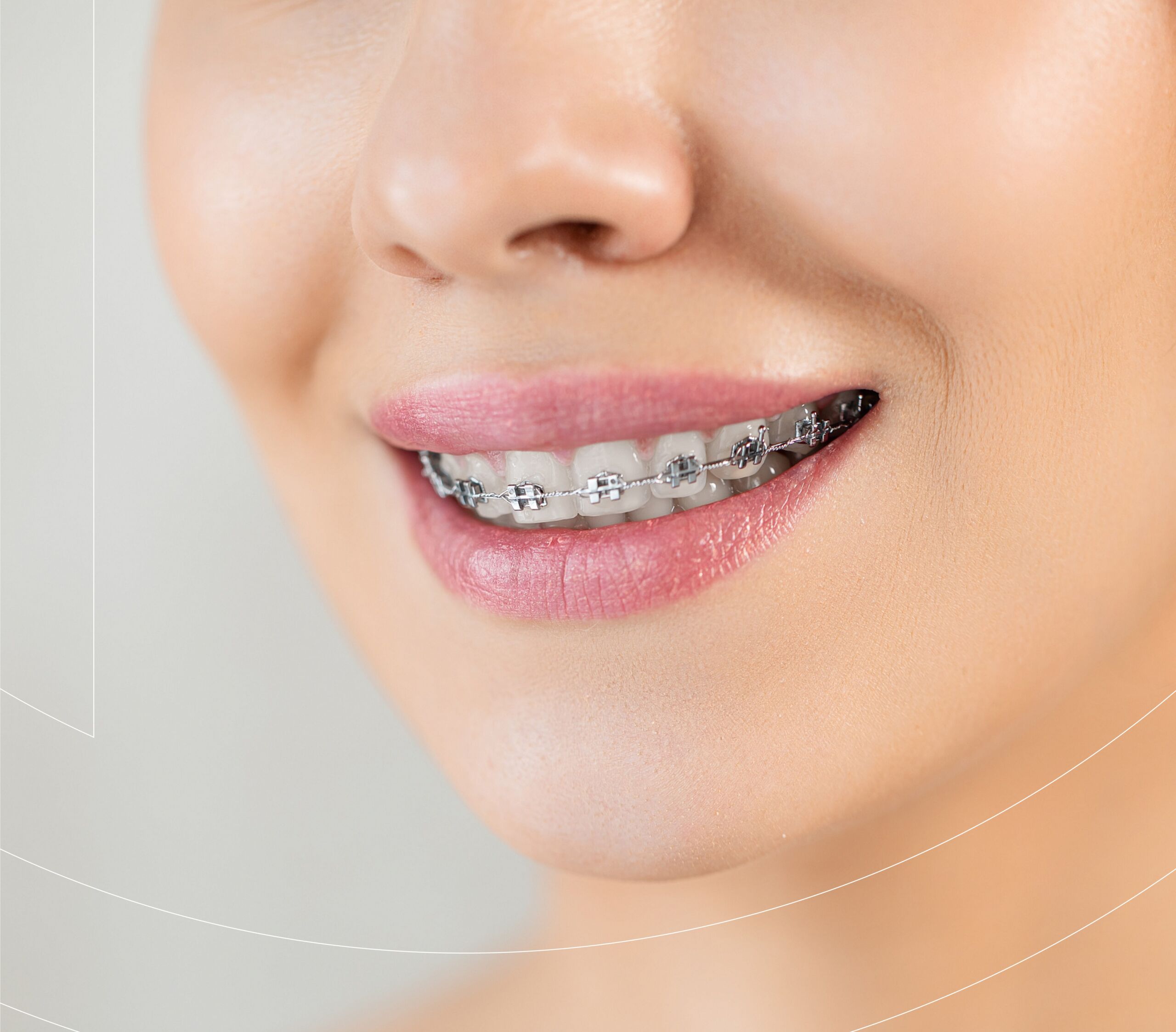 Монтажная область 48 e1746118724101 cocodental modern dental clinic providing professional care in uk