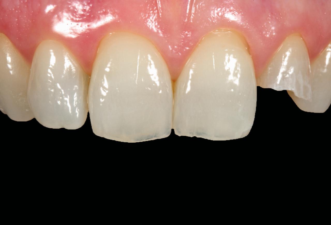 IMAGE 2025 05 06 113215 cocodental modern dental clinic providing professional care in uk