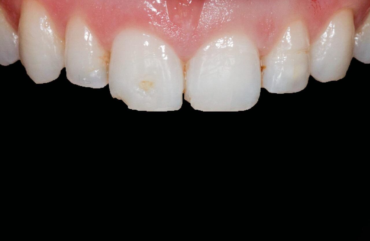 IMAGE 2025 05 06 113724 e1746650775832 cocodental modern dental clinic providing professional care in uk