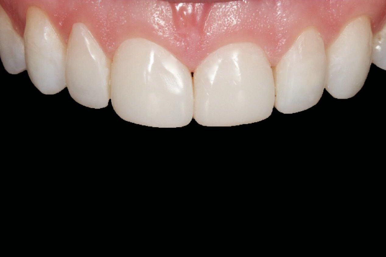IMAGE 2025 05 06 114049 cocodental modern dental clinic providing professional care in uk
