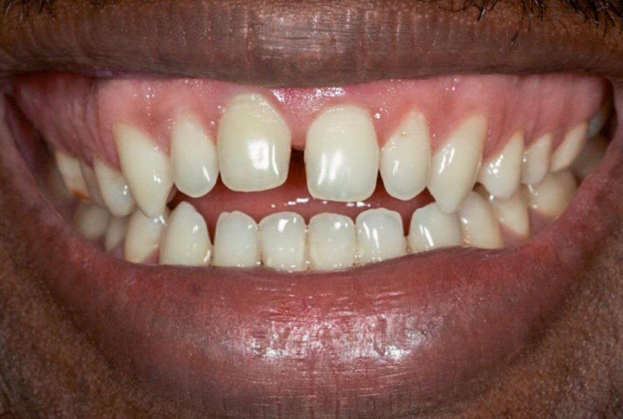 IMAGE 2025 05 06 114740 e1746650599880 cocodental modern dental clinic providing professional care in uk