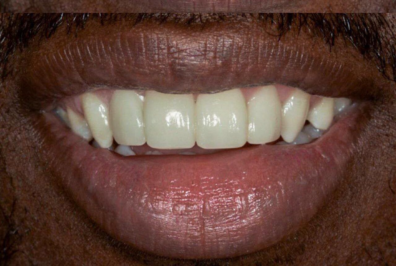 IMAGE 2025 05 06 114741 e1746650580369 cocodental modern dental clinic providing professional care in uk