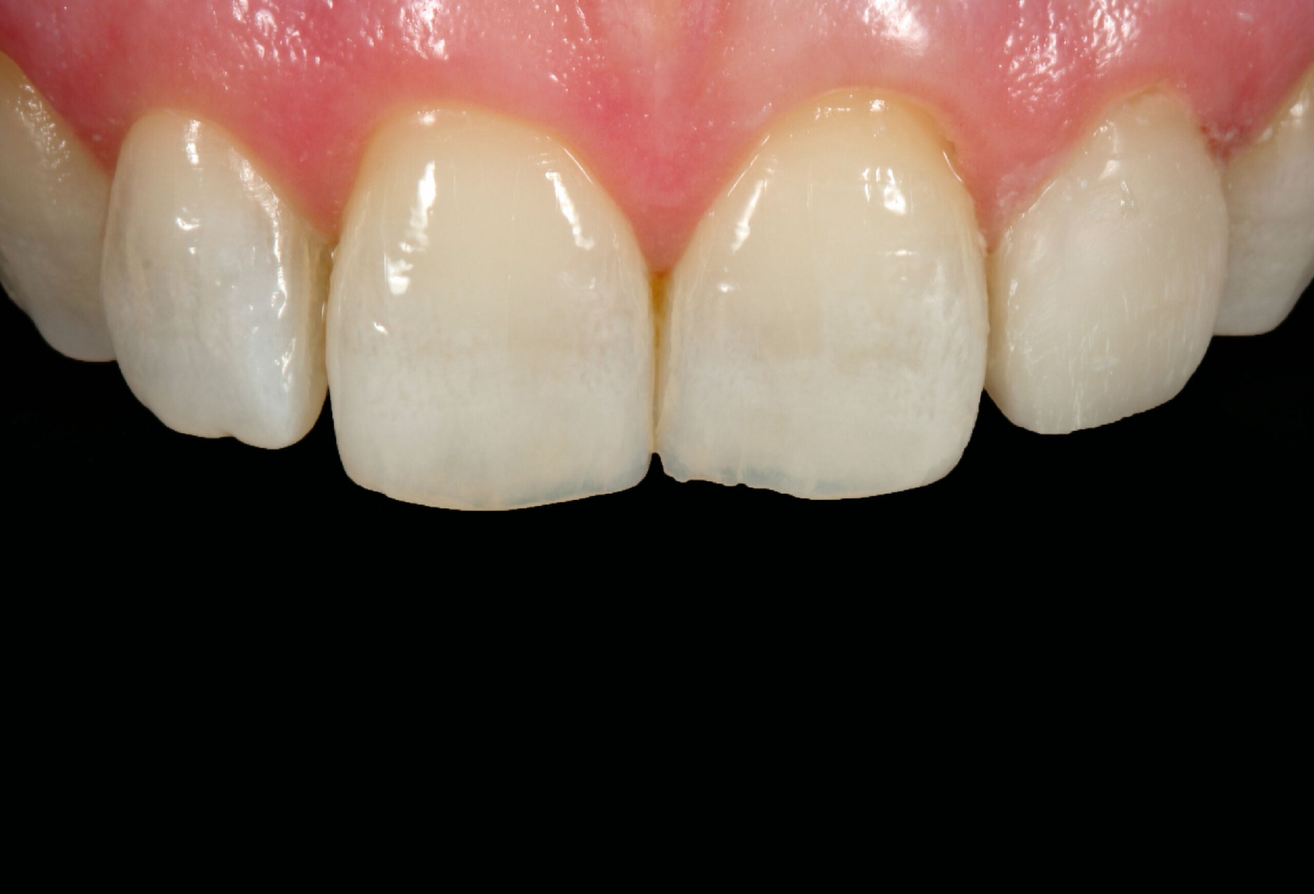 Smile Gallery 382 cocodental modern dental clinic providing professional care in uk