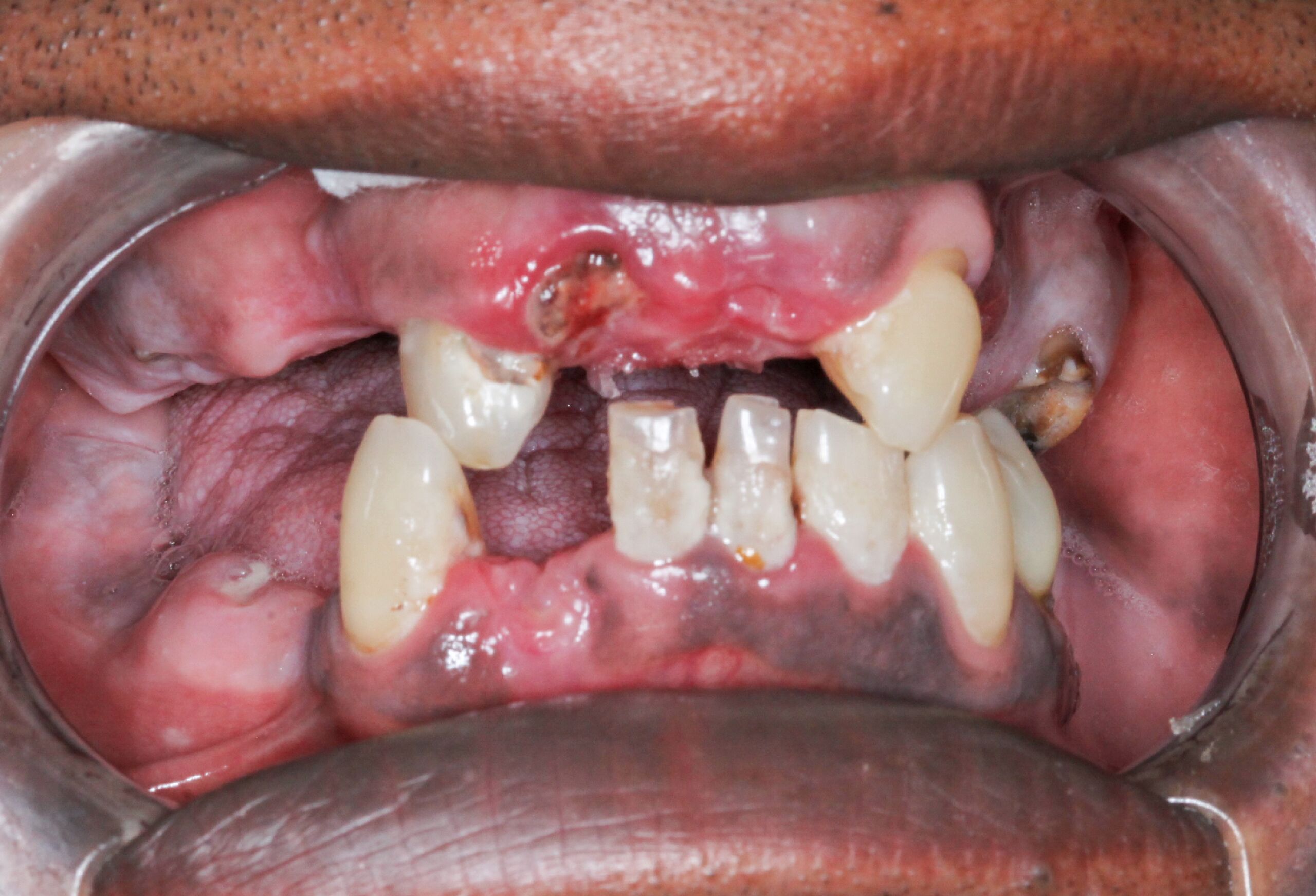 Smile Gallery 47 cocodental modern dental clinic providing professional care in uk