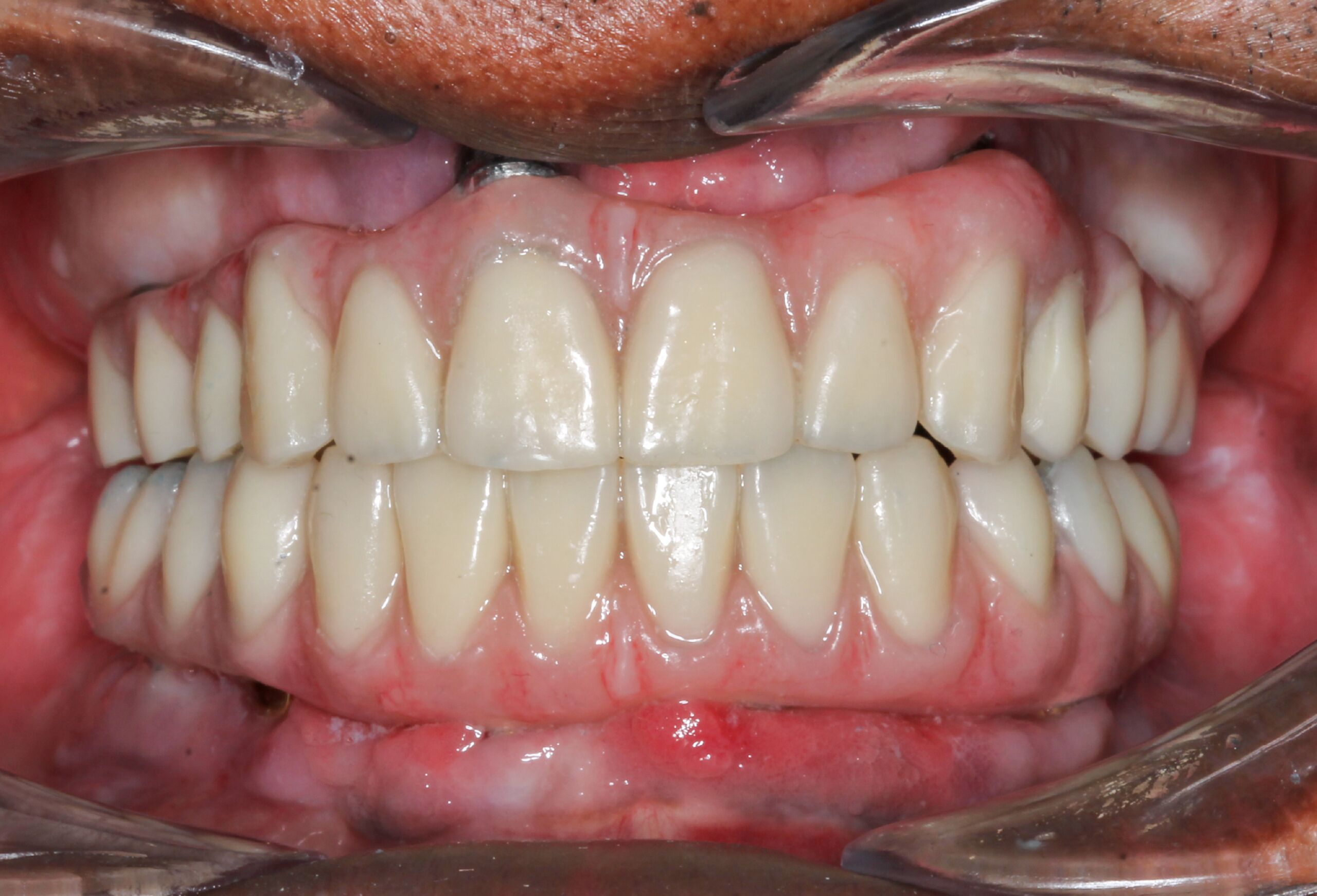 Smile Gallery 48 cocodental modern dental clinic providing professional care in uk
