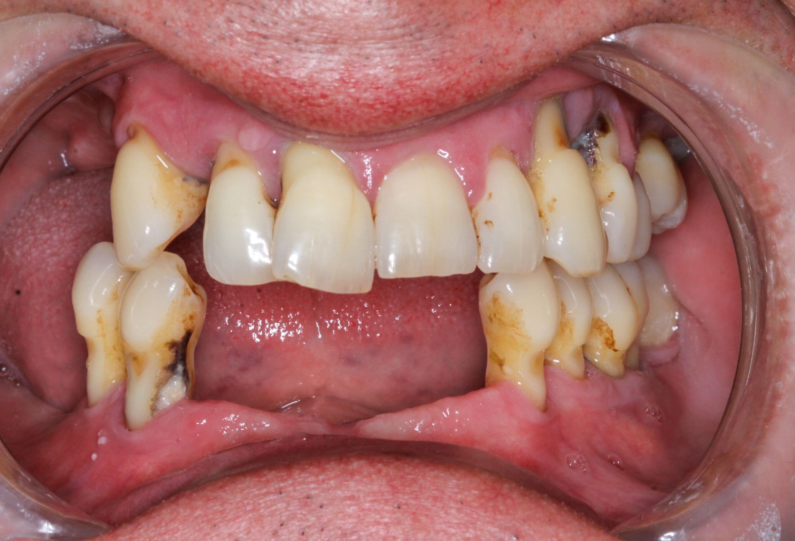 Smile Gallery 49 cocodental modern dental clinic providing professional care in uk