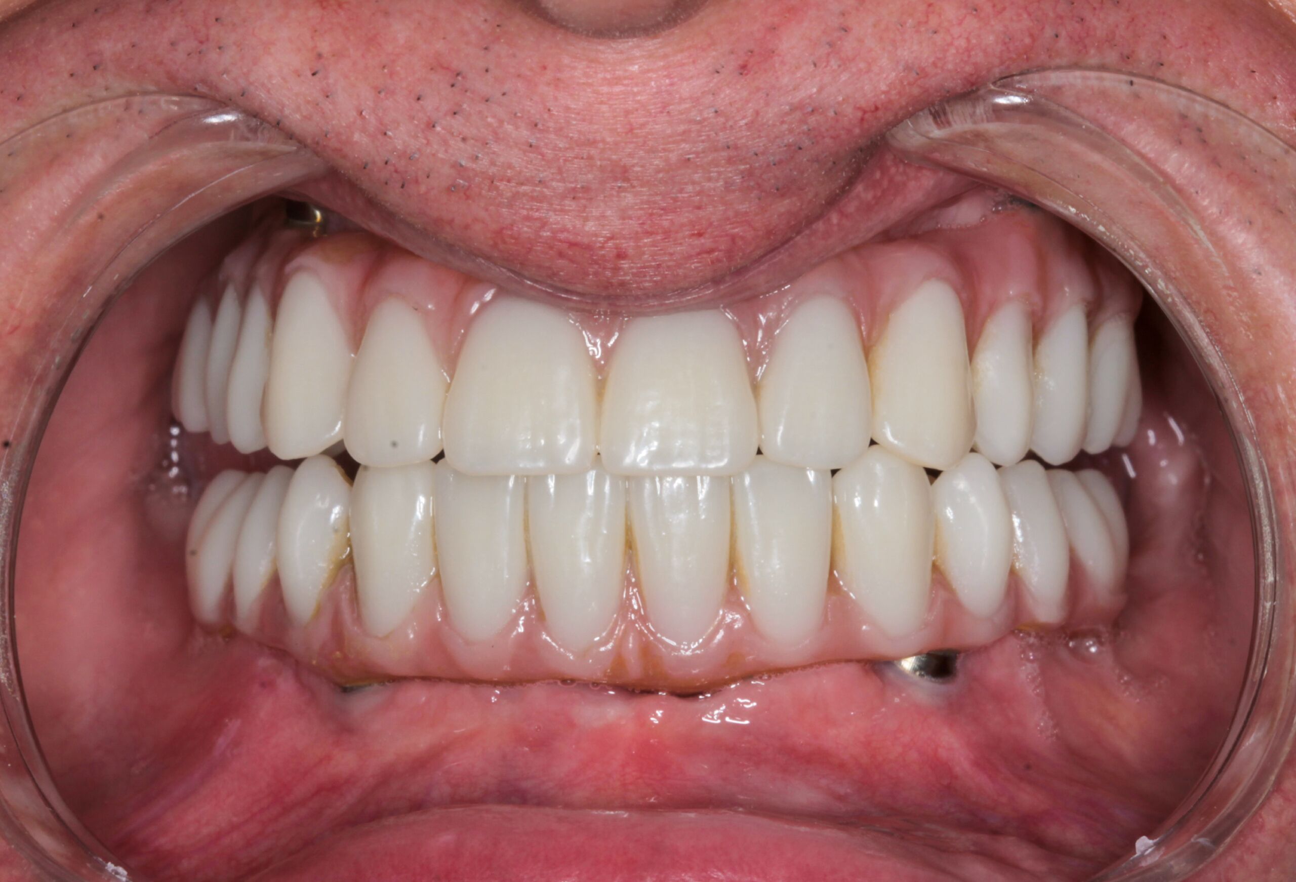 Smile Gallery 50 1 cocodental modern dental clinic providing professional care in uk