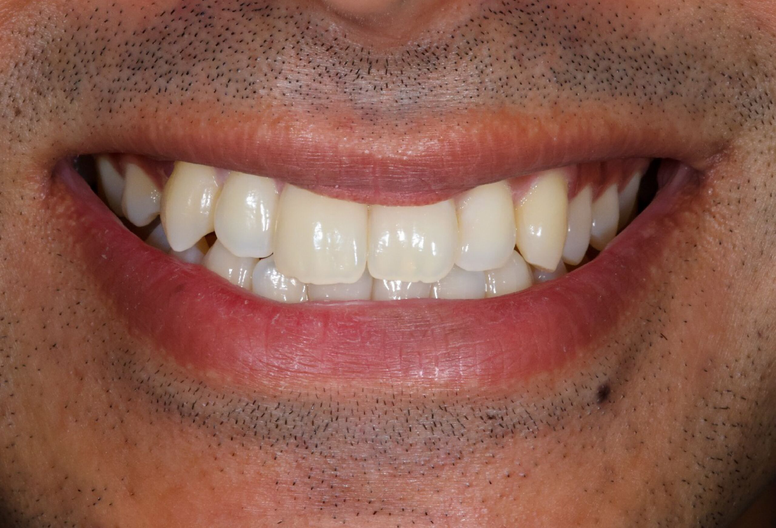 Smile Gallery 53 cocodental modern dental clinic providing professional care in uk