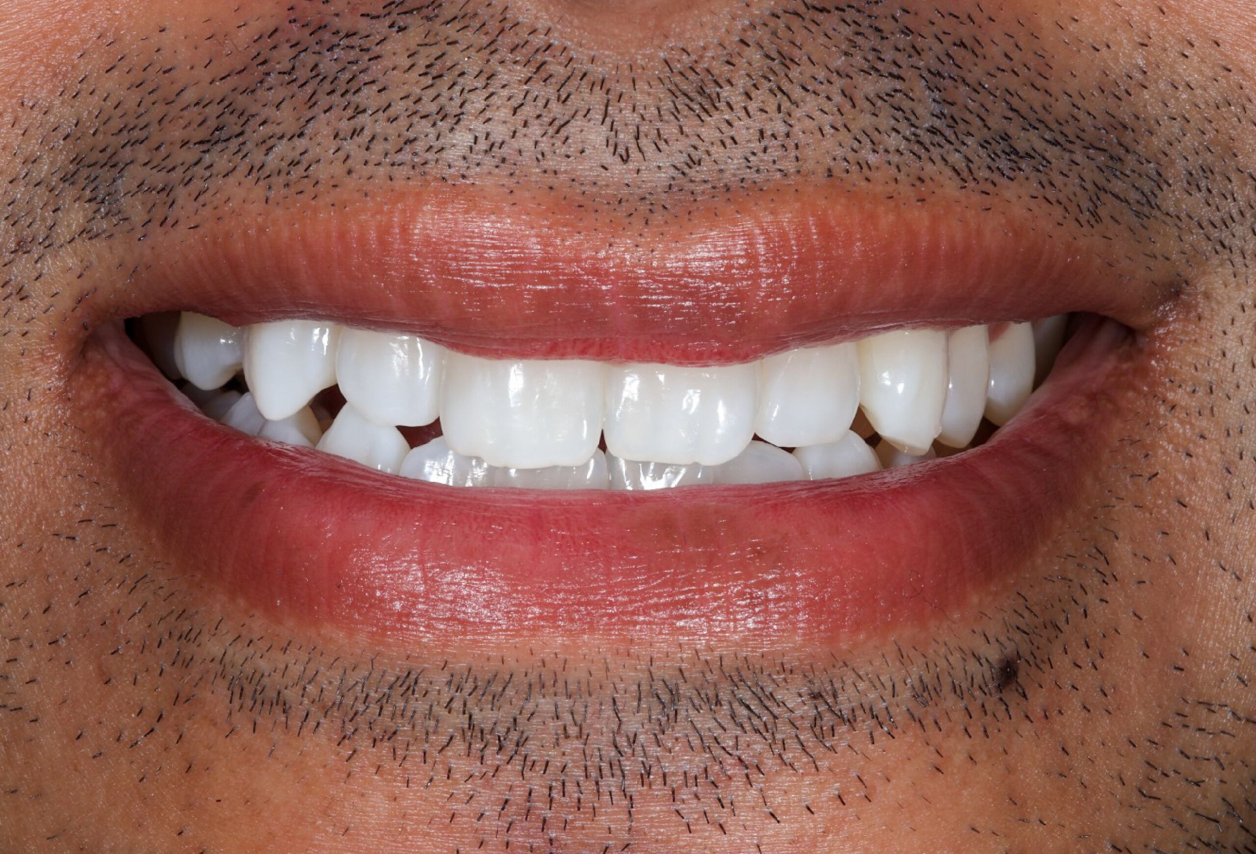 Smile Gallery 54 cocodental modern dental clinic providing professional care in uk