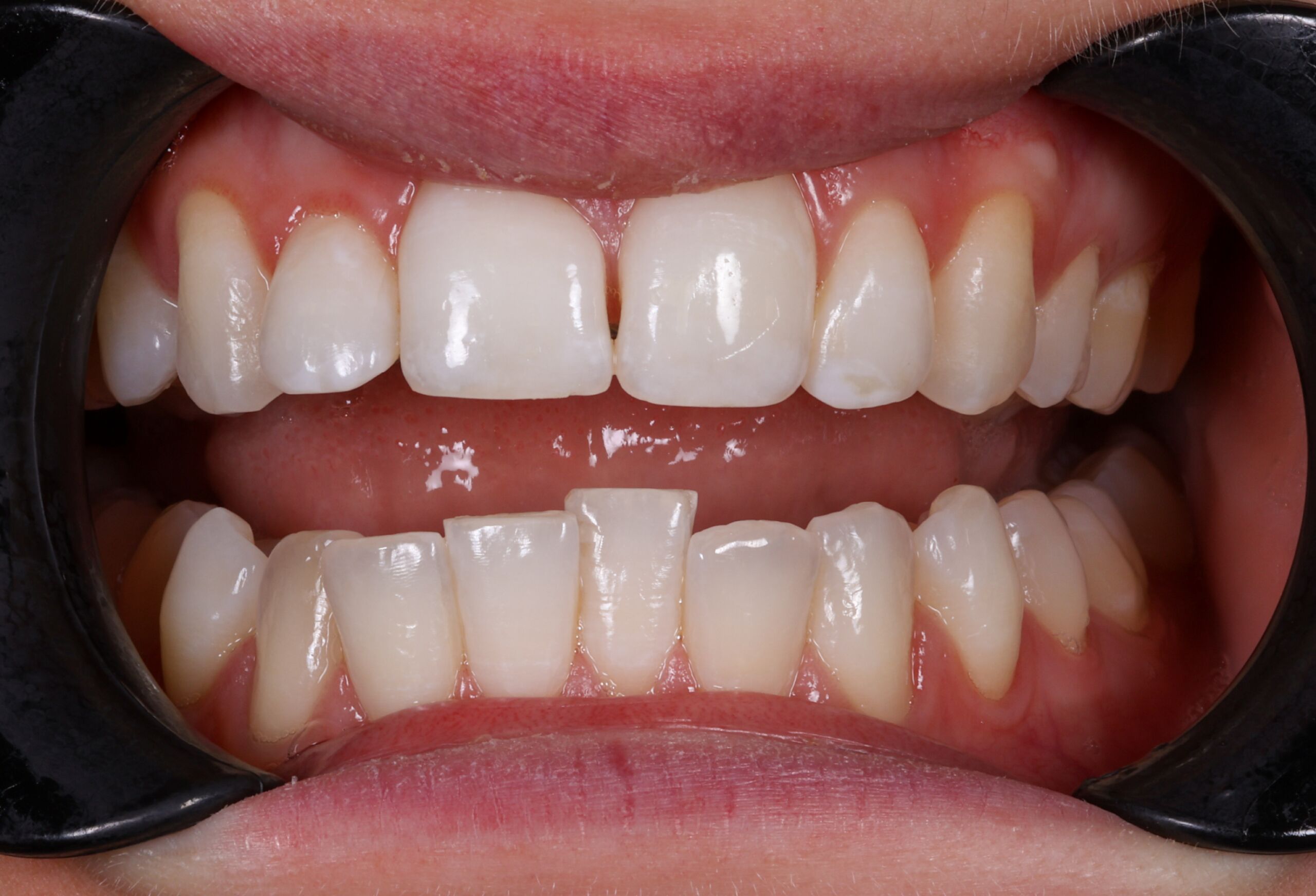 Smile Gallery 57 cocodental modern dental clinic providing professional care in uk