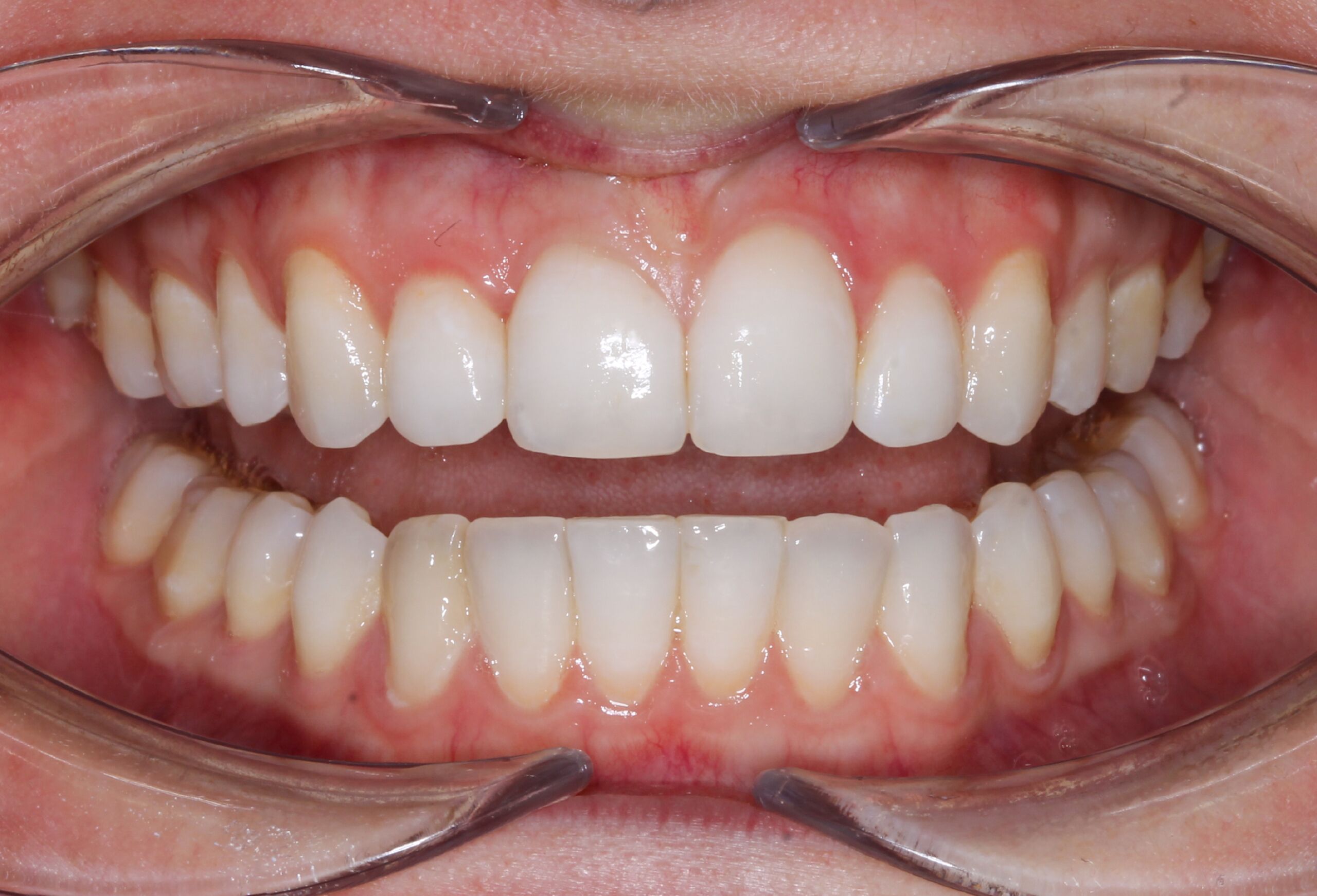 Smile Gallery 58 cocodental modern dental clinic providing professional care in uk