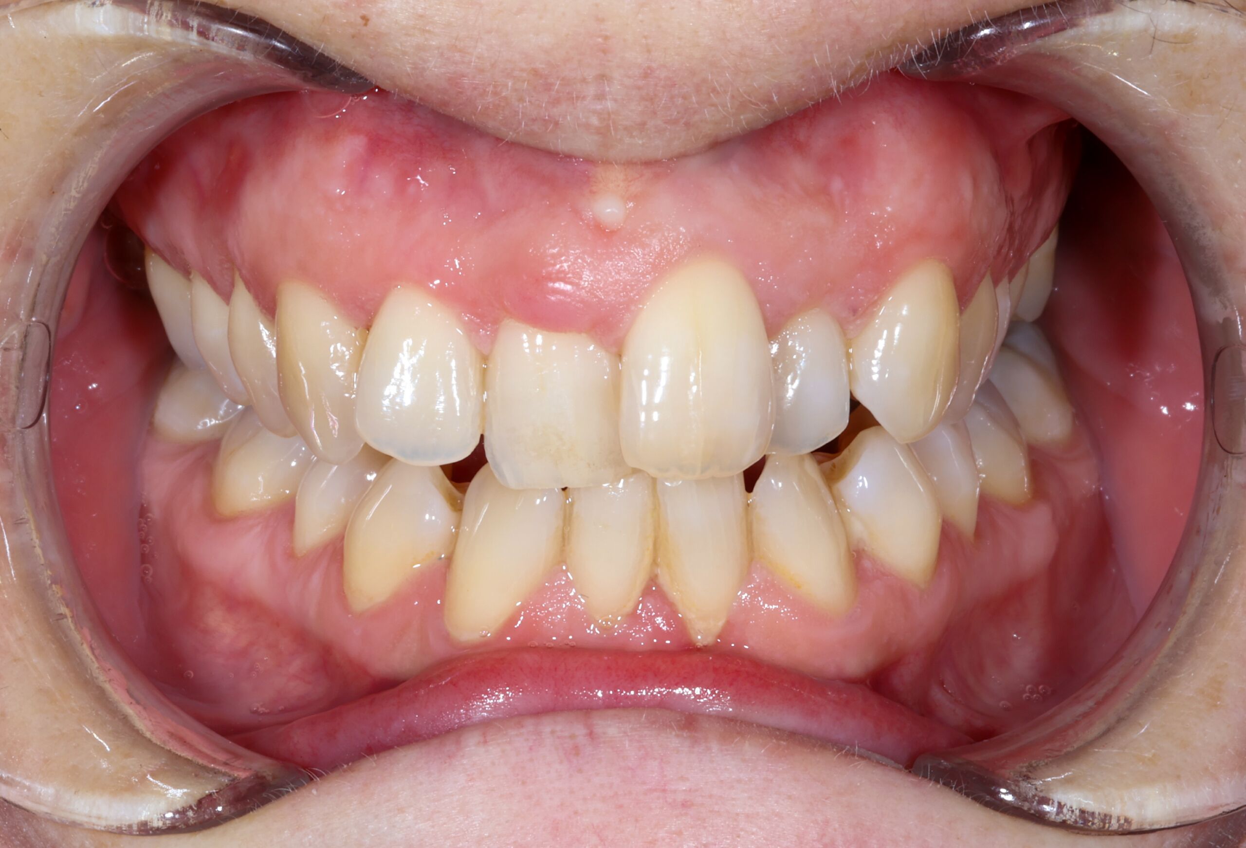 Smile Gallery 59 cocodental modern dental clinic providing professional care in uk