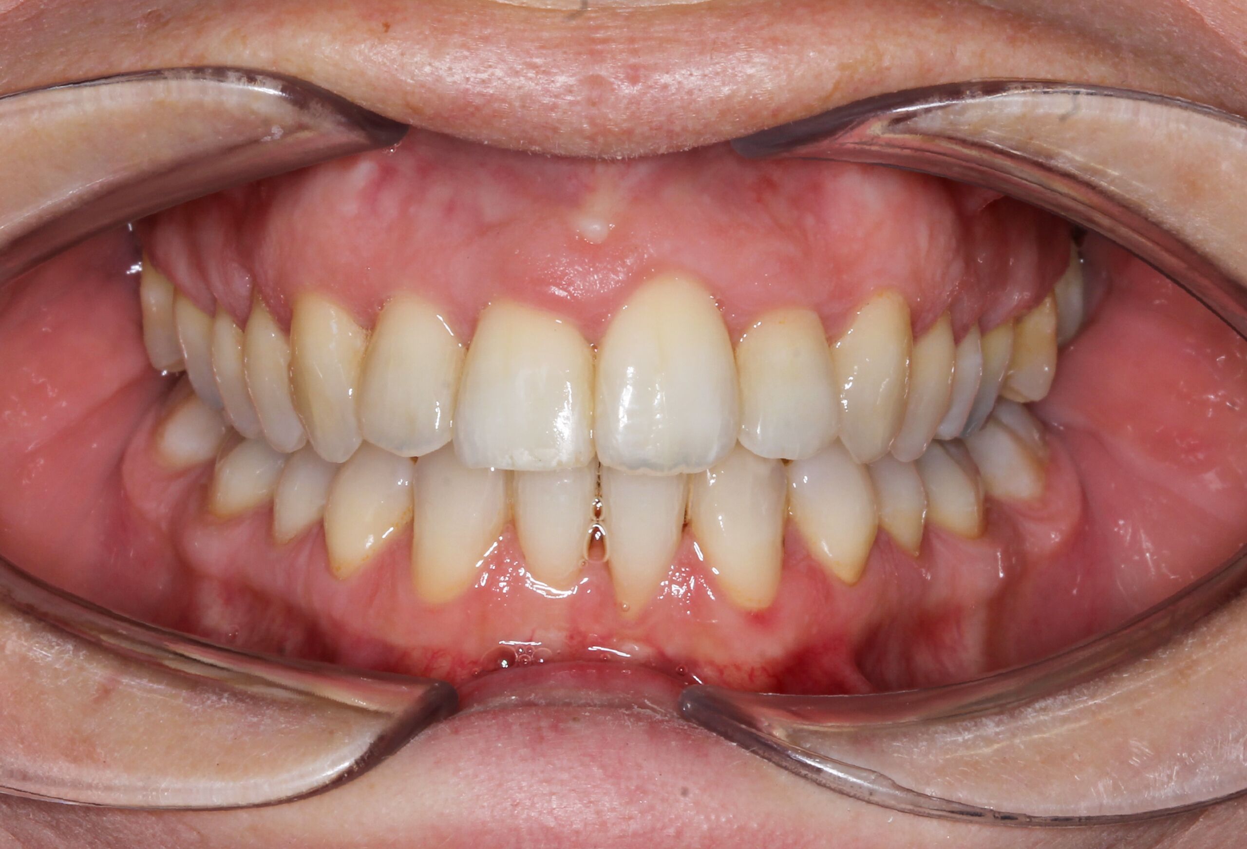 Smile Gallery 60 cocodental modern dental clinic providing professional care in uk