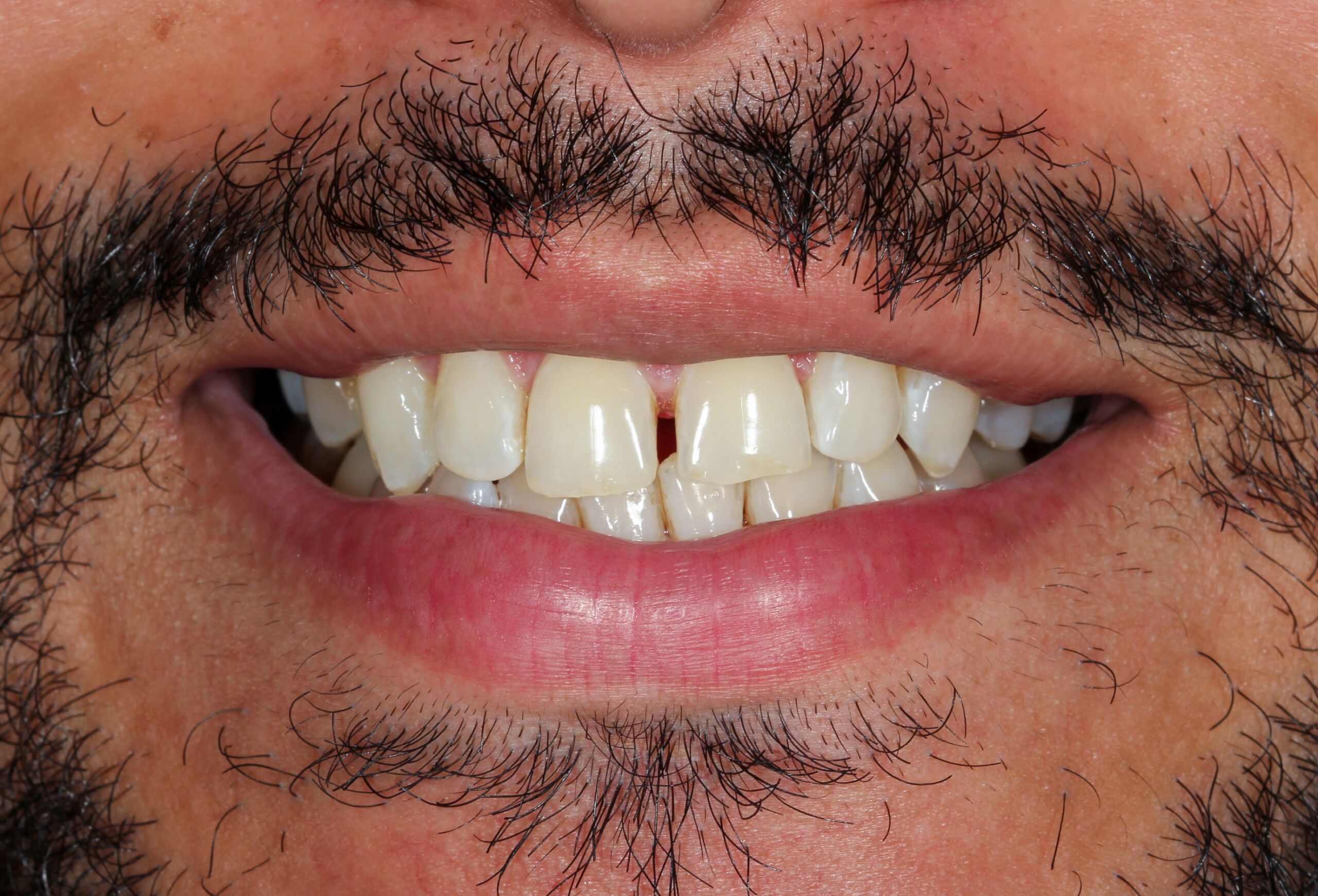 Smile Gallery 61 cocodental modern dental clinic providing professional care in uk
