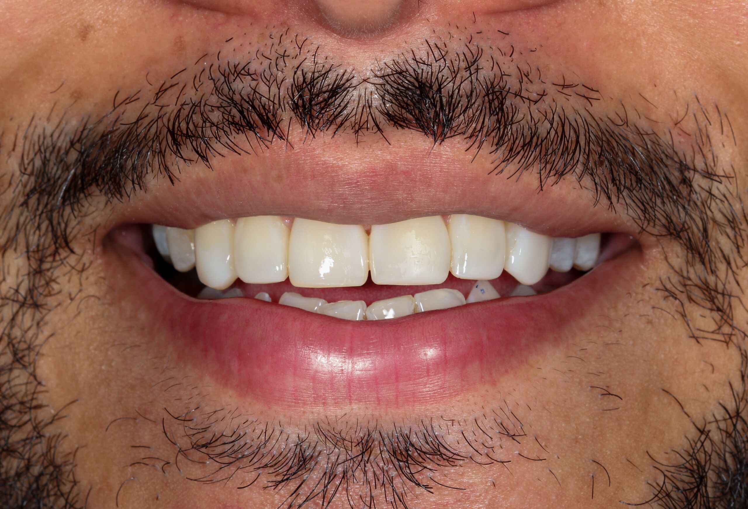 Smile Gallery 62 cocodental modern dental clinic providing professional care in uk