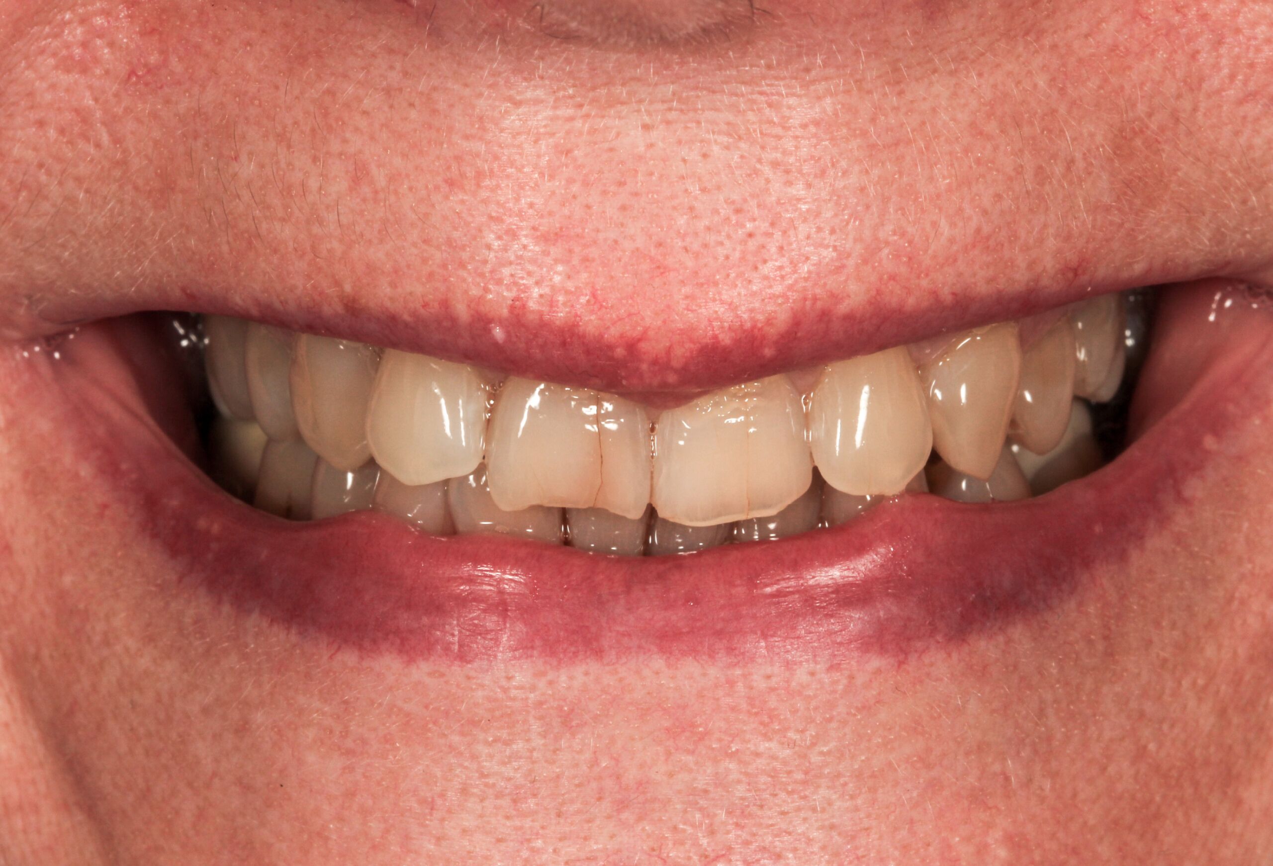 Smile Gallery 63 cocodental modern dental clinic providing professional care in uk