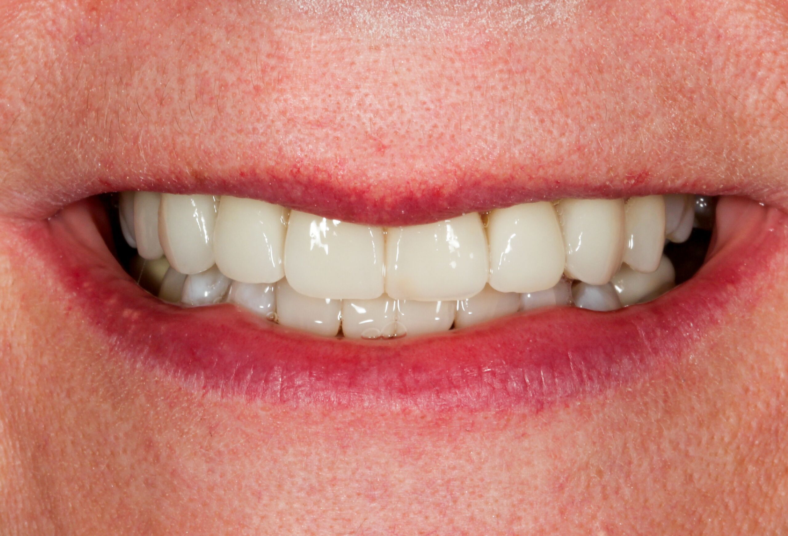 Smile Gallery 64 cocodental modern dental clinic providing professional care in uk