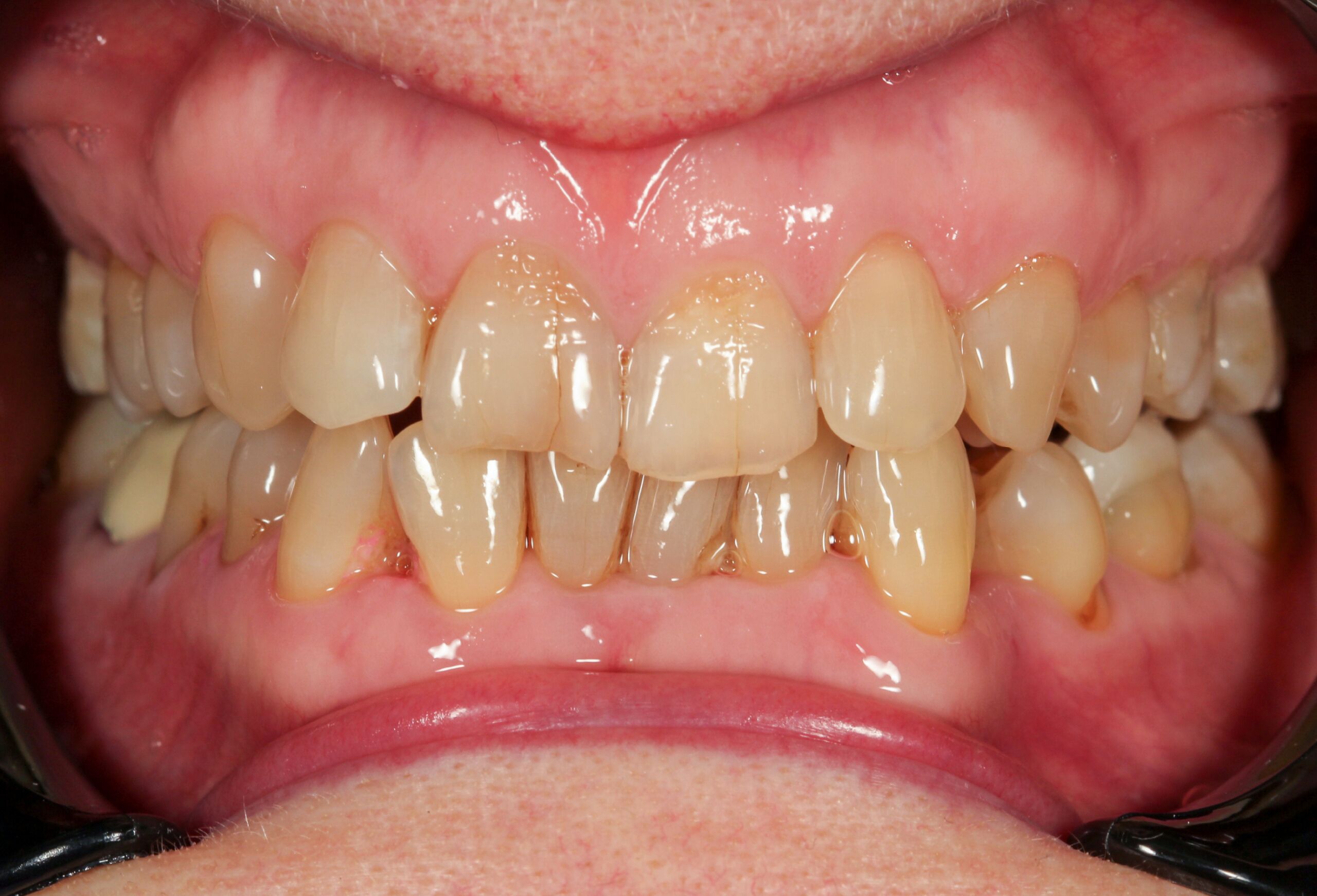 Smile Gallery 65 cocodental modern dental clinic providing professional care in uk