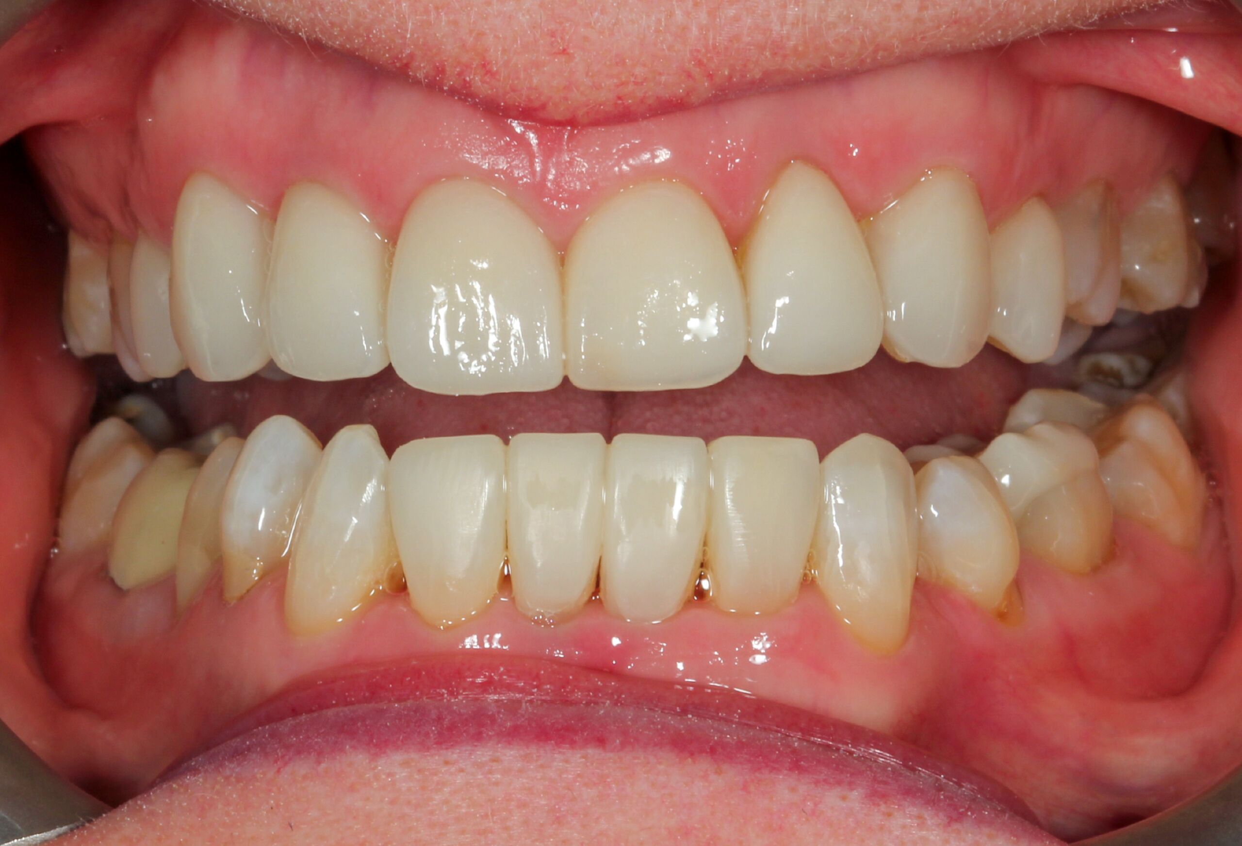 Smile Gallery 66 cocodental modern dental clinic providing professional care in uk