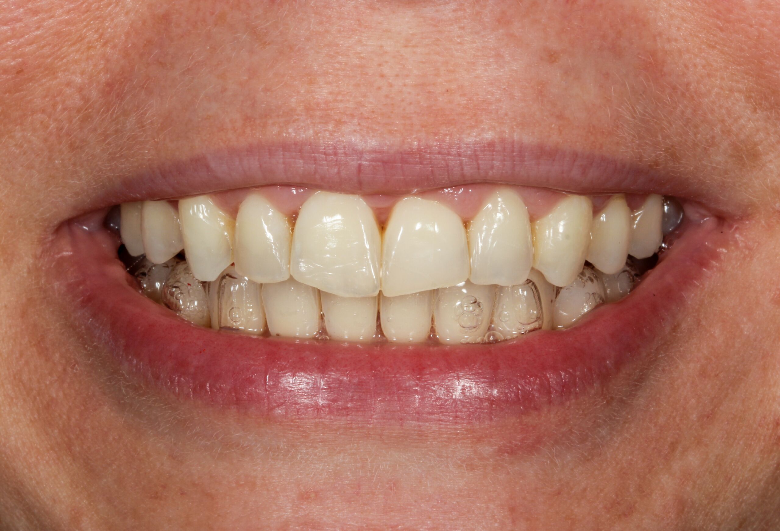Smile Gallery 67 cocodental modern dental clinic providing professional care in uk