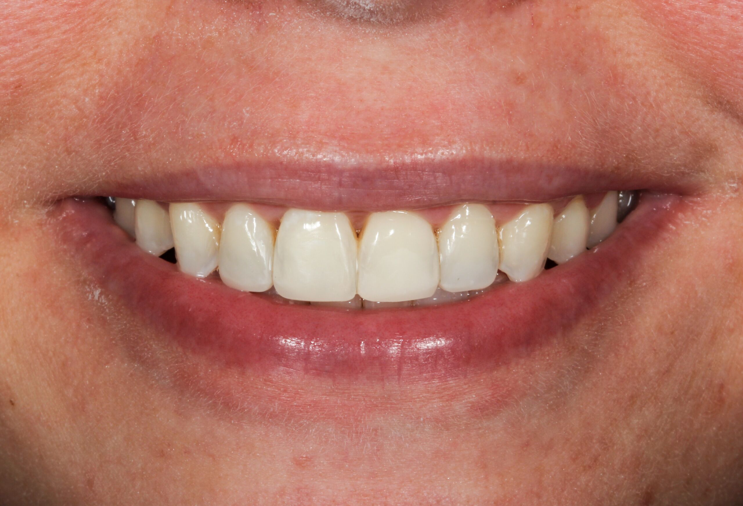 Smile Gallery 68 cocodental modern dental clinic providing professional care in uk