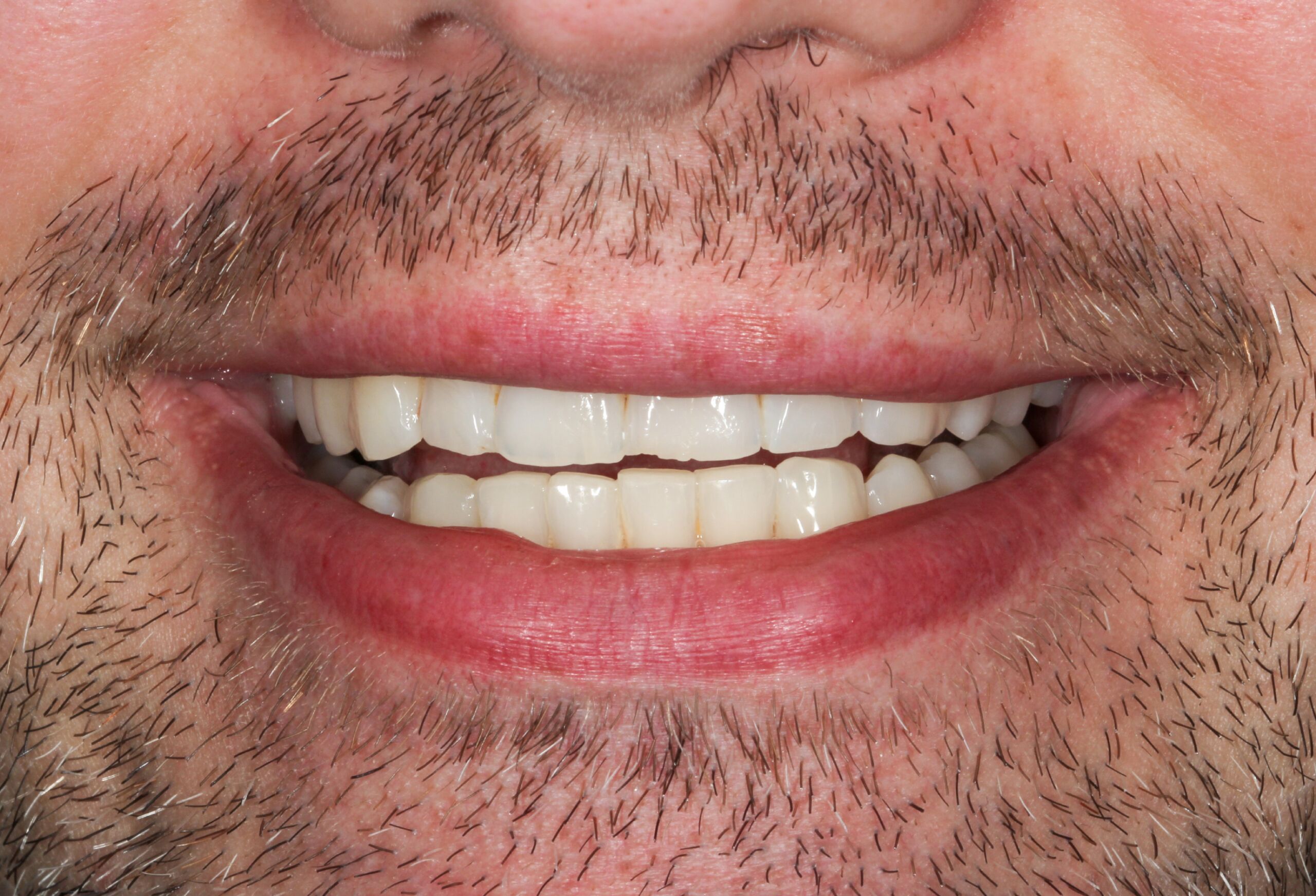 Smile Gallery 69 cocodental modern dental clinic providing professional care in uk