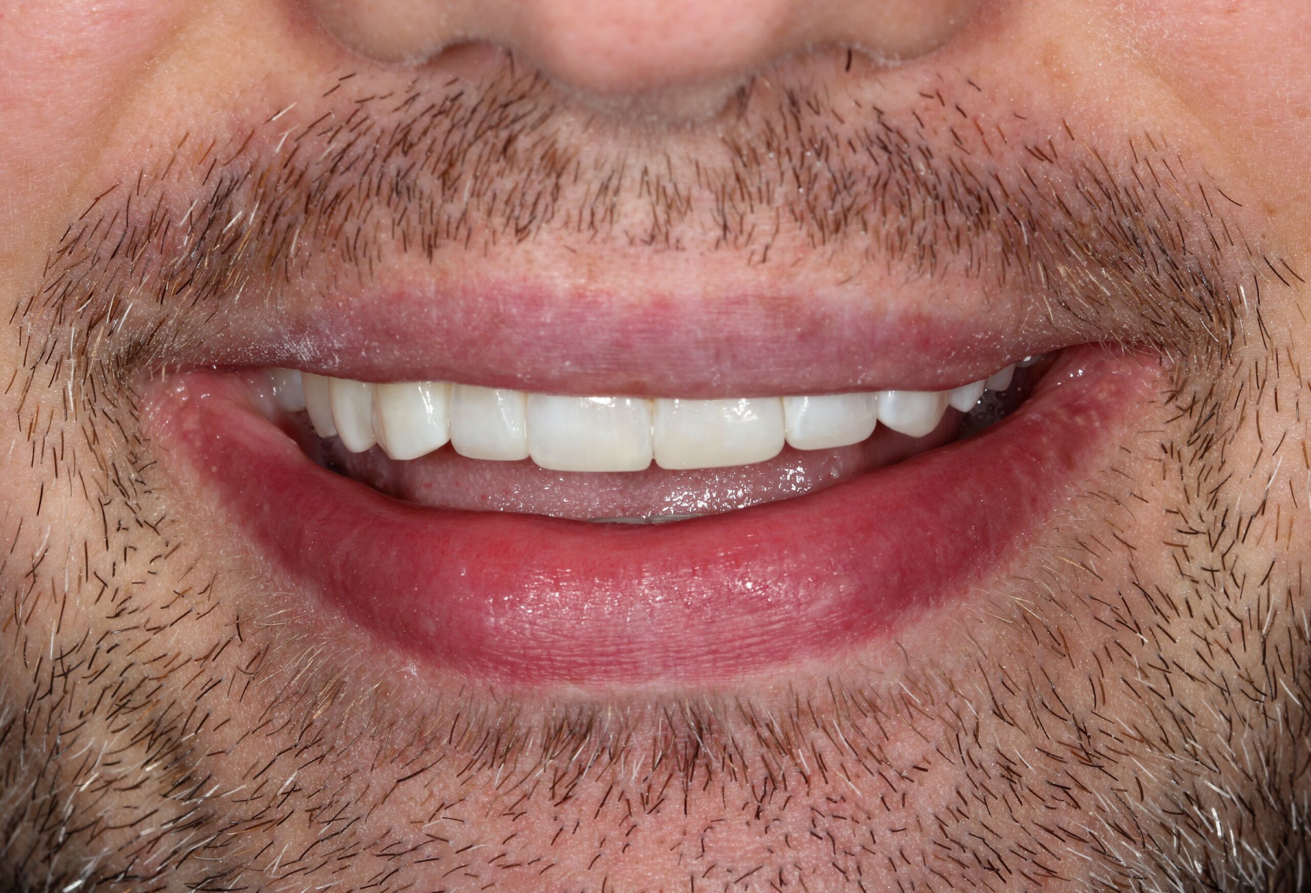 Smile Gallery 70 cocodental modern dental clinic providing professional care in uk